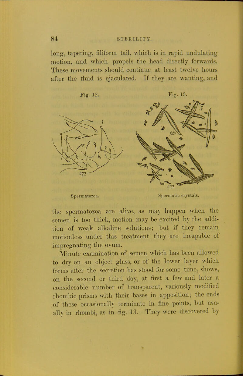 long, tapering, filiform tail, which is in rapid undulating motion, and which propels the head directly forwards. These movements should continue at least twelve hours after the fluid is ejaculated. If they arc wanting, and Fig. 12. Fig. 13. Spermatozoa. Spermatic crystals. the spermatozoa are alive, as may happen when the semen is too thick, motion may he excited by the addi- tion of weak alkaline solutions; but if they remain motionless under this treatment they are incapable of impregnating the ovum. Minute examination of semen which has been allowed to dry on an object glass, or of the lower layer which forms after the secretion has stood for some time, shows, on the second or third day, at first a few and later a considerable number of transparent, variously modified rhombic prisms with their bases in apposition; the ends of these occasionally terminate in fine points, but usu- ally in rhombi, as in fig. 13. They were discovered by