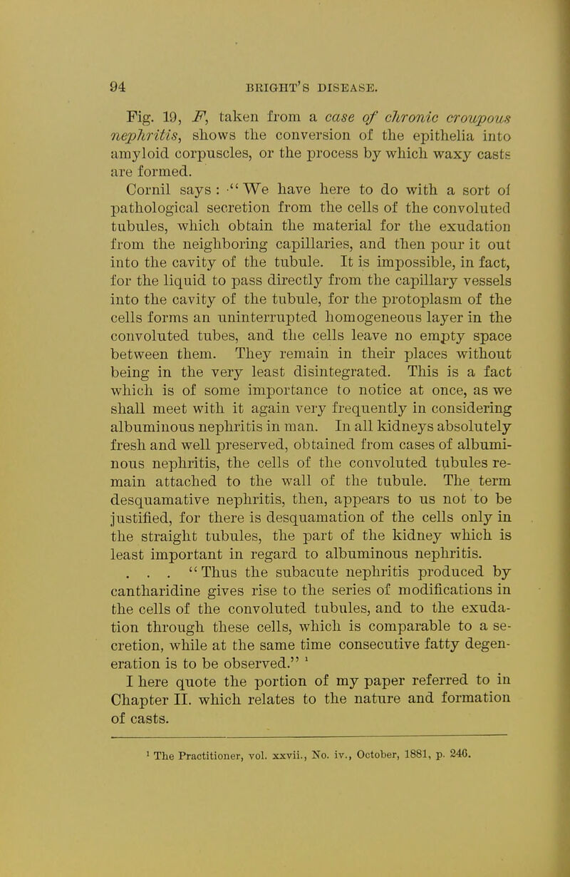 Fig. 19, -F, taken from a case of chronic croupous nepliritis, shows the conversion of the epithelia into amyloid corpuscles, or the process by which waxy caste are formed. Cornil says: We have here to do with a sort ol pathological secretion from the cells of the convoluted tubules, which obtain the material for the exudation from the neighboring capillaries, and then pour it out into the cavity of the tubule. It is impossible, in fact, for the liquid to pass directly from the capillary vessels into the cavity of the tubule, for the protoplasm of the cells forms an uninterrupted homogeneous layer in the convoluted tubes, and the cells leave no empty space between them. They remain in their places without being in the very least disintegrated. This is a fact which is of some importance to notice at once, as we shall meet with it again very frequently in considering albuminous nephritis in man. In all kidneys absolutely fresh and well preserved, obtained from cases of albumi- nous nephritis, the cells of the convoluted tubules re- main attached to the wall of the tubule. The term desquamative nephritis, then, appears to us not to be justified, for there is desquamation of the cells only in the straight tubules, the part of the kidney which is least important in regard to albuminous nephritis. . . . Thus the subacute nephritis produced by cantharidine gives rise to the series of modifications in the cells of the convoluted tubules, and to the exuda- tion through these cells, which is comparable to a se- cretion, while at the same time consecutive fatty degen- eration is to be observed. ' I here quote the portion of my paper referred to in Chapter II. which relates to the nature and formation of casts. ' The Practitioner, vol. xxvii., No. iv., October, 1881, p. 246.
