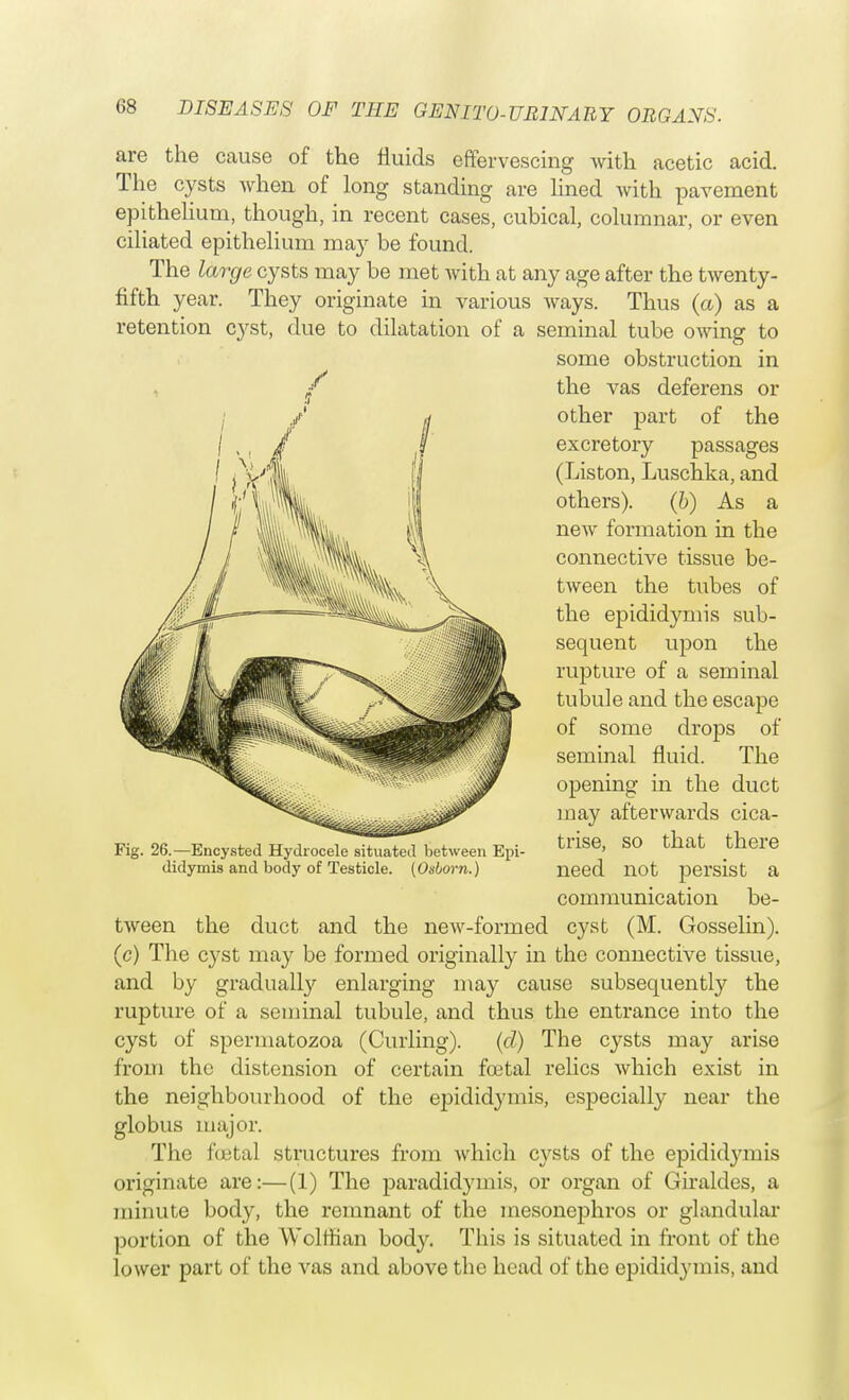 are the cause of the fluids effervescing with acetic acid. The cysts when of long standing are lined with pavement epithelium, though, in recent cases, cubical, columnar, or even ciliated epithelium may be found. The large cysts may be met with at any age after the twenty- fifth year. They originate in various ways. Thus (a) as a retention cyst, due to dilatation of a seminal tube owing to some obstruction in the vas deferens or other part of the excretory passages (Liston, Luschka, and others). (b) As a new formation in the connective tissue be- tween the tubes of the epididymis sub- sequent upon the rupture of a seminal tubule and the escape of some drops of seminal fluid. The opening in the duct may afterwards cica- trise, so that there need not persist a communication be- tween the duct and the new-formed cyst (M. Gosselin). (c) The cyst may be formed originally in the connective tissue, and by gradually enlarging may cause subsequently the rupture of a seminal tubule, and thus the entrance into the cyst of spermatozoa (Curling). (cl) The cysts may arise from the distension of certain foetal relics which exist in the neighbourhood of the epididymis, especially near the globus major. The foetal structures from which cysts of the epididymis originate are:—(1) The paradidymis, or organ of Giraldes, a minute body, the remnant of the mesonephros or glandular portion of the Wolffian body. This is situated in front of the lower part of the vas and above the head of the epididymis, and Fig. 26.—Encysted Hydrocele situated between Epi- didymis and body of Testicle. (Osborn.)