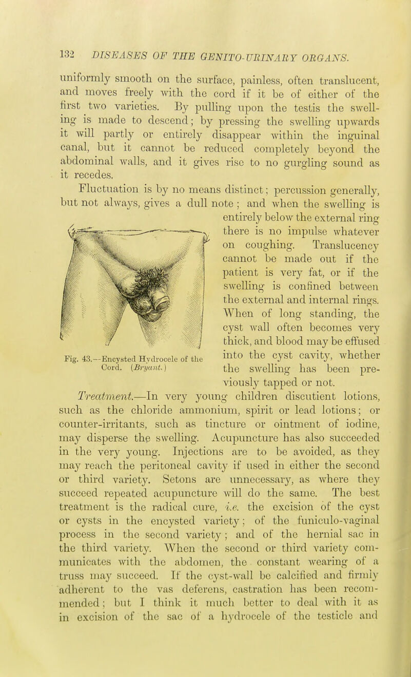 uniformly smooth on the surface, painless, often translucent, and moves freely with the cord if it be of either of the first two varieties. By pulling upon the testis the swell- ing is made to descend; by pressing the swelling upwards it will partly or entirely disappear within the inguinal canal, but it cannot be reduced completely beyond the abdominal walls, and it gives rise to no gurgling sound as it recedes. Fluctuation is by no means distinct; percussion generally, but not always, gives a dull note ; and when the swelling is entirely below the external ring Fig. 43. — Encysted Hydrocele of the Cord. (Bryant.) there is no impulse whatever on coughing. Translucency cannot bo made out if the patient is very fat, or if the swelling is confined between the external and internal rings. When of long standing, the cyst wall often becomes very thick, and blood may be effused into the cyst cavity, whether the swelling has been pre- viously tapped or not. Treatment.—In very young children discutient lotions, such as the chloride ammonium, spirit or lead lotions; or counter-irritants, such as tincture or ointment of iodine, may disperse the swelling. Acupuncture has also succeeded in the veiy young. Injections are to be avoided, as they may reach the peritoneal cavity if used in either the second or third variety. Setons are unnecessary, as where they succeed repeated acupuncture will do the same. The best treatment is the radical cure, i.e. the excision of the cyst or cysts in the encysted variety: of the funiculo-vaginal process in the second variety ; and of the hernial sac in the third variety. When the second or third variety com- municates with the abdomen, the constant wearing of a truss may succeed. If the cyst-wall be calcined and firmly adherent to the vas deferens, castration has been recom- mended : but I think it much better to deal with it as in excision of the sac of a hydrocele of the testicle and
