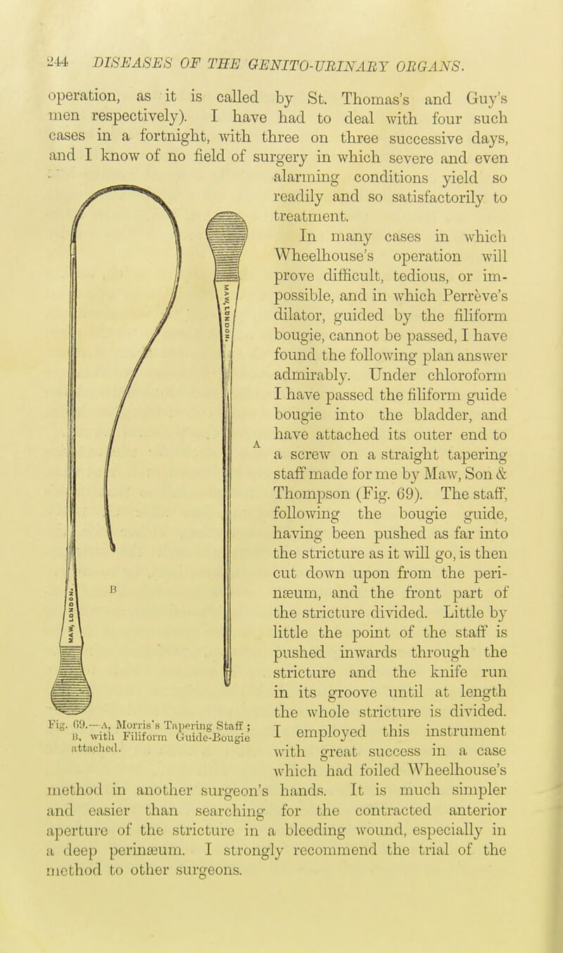 operation, as it is called by St. Thomas's and Guy's men respectively). I have had to deal with four such cases in a fortnight, with three on three successive days, and I know of no field of surgery in which severe and even alarming conditions yield so readily and so satisfactorily to treatment. In many cases in which Wheelhouse's operation will prove difficult, tedious, or im- possible, and in which Perreve's dilator, guided by the filiform bougie, cannot be passed, I have found the following plan answer admirably. Under chloroform I have passed the filiform guide bougie into the bladder, and have attached its outer end to a screw on a straight tapering- staff made for me by Maw, Son & Thompson (Fig. 69). The staff, following the bougie guide, having been pushed as far into the stricture as it will go, is then cut down upon from the peri- nseum, and the front part of the stricture divided. Little by little the point of the staff is pushed inwards through the , 09.—a, Morris's Tapering Staff ; B, with Filiform Guide-Bougie attached. stricture and the knife run in its groove until at length the whole stricture is divided. I employed this instrument with o-reat success in a case which had foiled Wheelhouse's method in another surgeon's hands. It is much simpler and easier than searching for the contracted anterior aperture of the stricture in a bleeding wound, especially in a deep perineum. I strongly recommend the trial of the method to other surgeons.