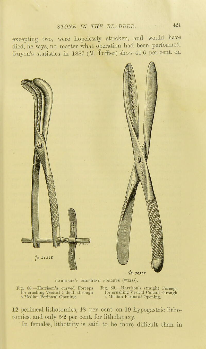 excepting two, were hopelessly stricken, and would have died, he says, no matter what operation had heen performed. Guyon's statistics in 188V (M. Turner) show 41*6 per cent, on Harrison's crushing roiiCErs (weiss). Fig. 88.—Harrison's curved Forceps Fig. 89.—Harrison's straight Forceps for crashing Vesical Calculi through for crushing Vesical Calculi through a Median Perineal Opening. a Median Perineal Opening. 12 perimeal lithotomies, 48 per cent, on 19 hypogastric litho- tomies, and only 5-2 per cent, for litholapaxy. In females, lithotrity is said to be more difficult than in