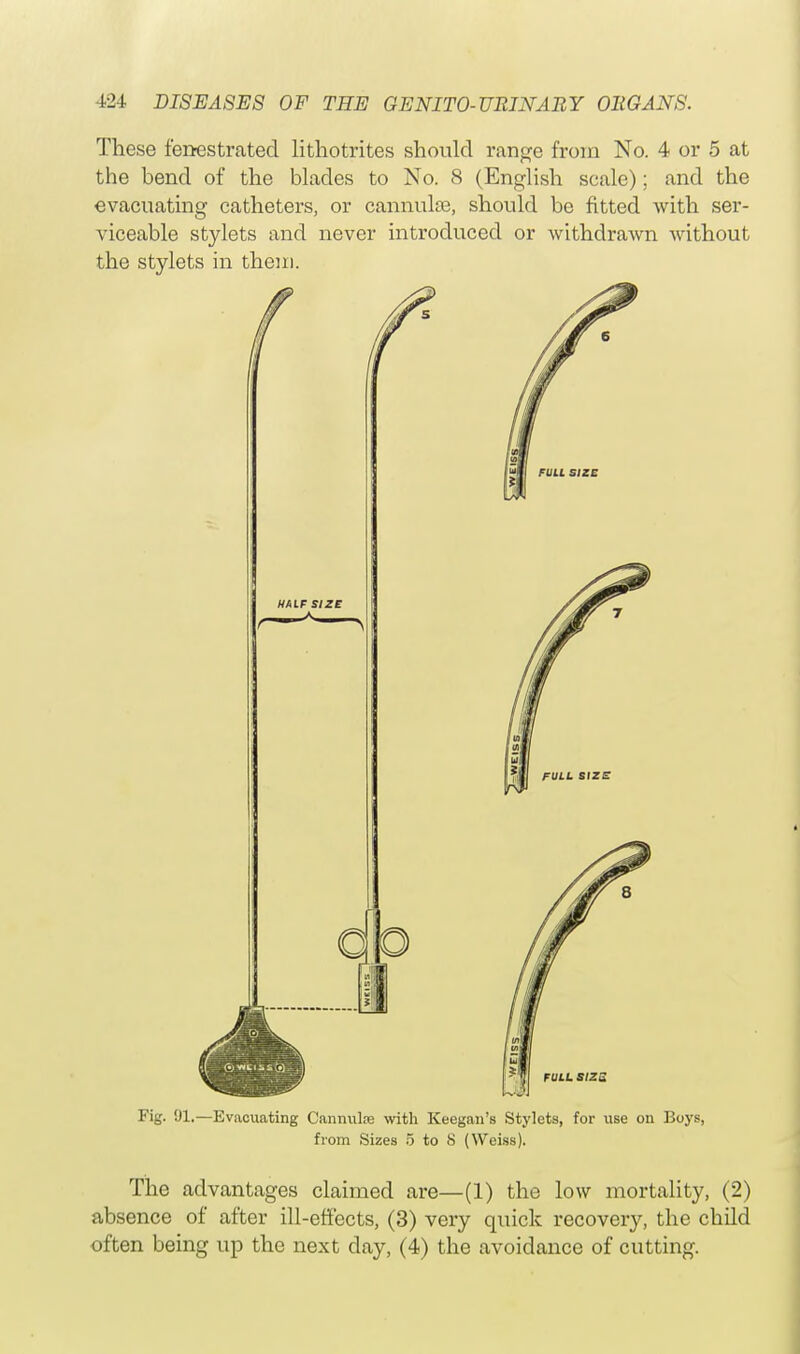These fenestrated lithotrites should range from No. 4 or 5 at the bend of the blades to No. 8 (English scale); and the evacuating catheters, or cannula?, should be fitted with ser- viceable stylets and never introduced or withdrawn without the stylets in them. Fig. 91.—Evacuating Cannula? with Keegan's Stylets, for use on Boys, from Sizes 5 to S (Weiss). The advantages claimed are—(1) the low mortality, (2) absence of after ill-effects, (3) very quick recovery, the child often being up the next day, (4) the avoidance of cutting.