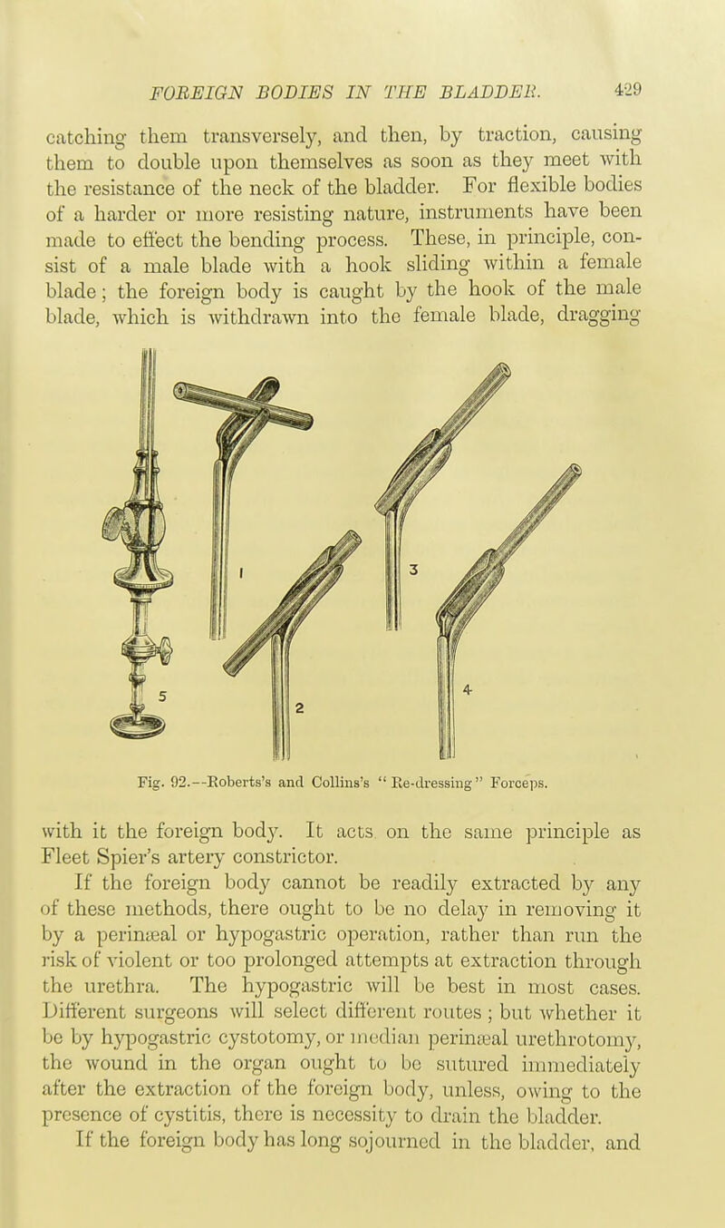 catching them transversely, and then, by traction, causing them to double upon themselves as soon as they meet with the resistance of the neck of the bladder. For flexible bodies of a harder or more resisting nature, instruments have been made to effect the bending process. These, in principle, con- sist of a male blade with a hook sliding within a female blade; the foreign body is caught by the hook of the male blade, which is withdrawn into the female blade, dragging Fig. 92.— Roberts's and Collins's  Ee-dressing  Forceps. with it the foreign body. It acts on the same principle as Fleet Spier's artery constrictor. If the foreign body cannot be readily extracted by any of these methods, there ought to be no delay in removing it by a perinseal or hypogastric operation, rather than run the risk of violent or too prolonged attempts at extraction through the urethra. The hypogastric will be best in most cases. Different surgeons will select different routes ; but whether it be by hypogastric cystotomy, or median perineal urethrotomy, the wound in the organ ought to be sutured immediately after the extraction of the foreign body, unless, owing to the presence of cystitis, there is necessity to drain the bladder. If the foreign body has long sojourned in the bladder, and