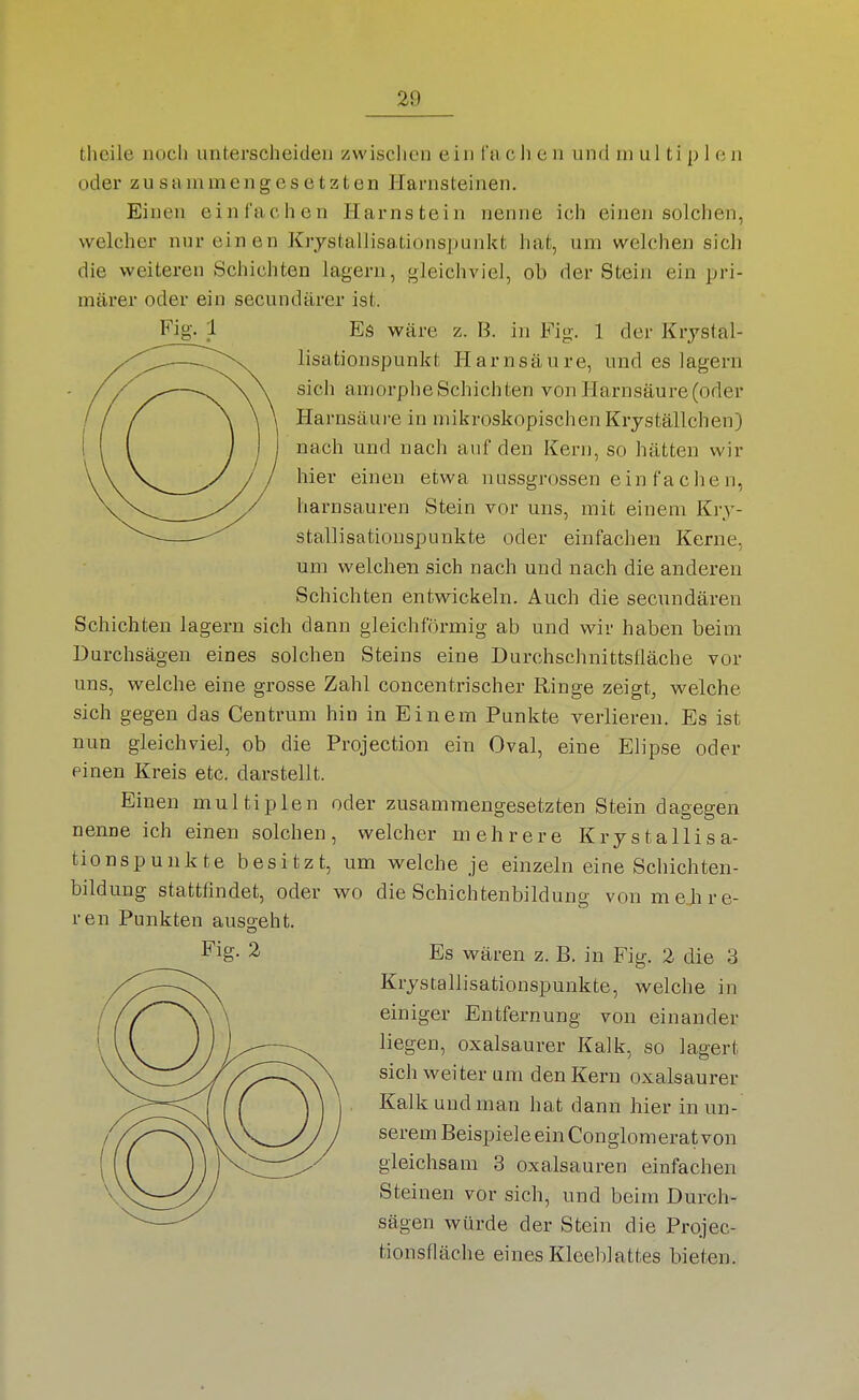 theile nocli unterscheiden zwisclien ein fa c h e n und multiple n oder zusammengesetzton Harnsteinen. Einen einfachen Harnstein nenne ich einen solchen, welcher nur einen Krjstallisationspunkt hat, um welchen sich die weiteren Schichten lagern, gleichviel, ob der Stein ein pri- märer oder ein secundärer ist. Fig. ;i Es wäre z. B. in Fig. 1 der Krjstal- lisationspunkt Harnsäure, und es lagern sich amorphe Schichten von Harnsäure (oder Harnsäure in mikroskopischen Kryställchen) nach und nach auf den Kern, so hätten wir hier einen etwa nussgrossen ein fache n, harnsauren Stein vor uns, mit einem Kiy- stallisationspunkte oder einfachen Kerne, um welchen sich nach und nach die anderen Schichten entwickeln. Auch die secundären Schichten lagern sich dann gleichförmig ab und wir haben beim Durchsägen eines solchen Steins eine Durchschnittsfläche vor uns, welche eine grosse Zahl concentrischer Ringe zeigt, welche sich gegen das Centrum hin in Einem Punkte verlieren. Es ist nun gleichviel, ob die Projection ein Oval, eine Elipse oder einen Kreis etc. darstellt. Einen multiplen oder zusammengesetzten Stein dagegen nenne ich einen solchen, welcher mehrere Krystallisa- tionspuukte besitzt, um welche je einzeln eine Schichten- bildung stattfindet, oder wo die Schichtenbildung vonmejire- ren Punkten ausgeht. Fig. 2 Es wären z. B. in Fig. 2 die 3 Krystallisationspunkte, welche in einiger Entfernung von einander liegen, oxalsaurer Kalk, so lagert sich weiter um den Kern oxalsaurer Kalk und man hat dann hier in un- serem Beispiele ein Conglom erat von gleichsam 8 Oxalsäuren einfachen Steinen vor sich, und beim Durch- sägen würde der Stein die Projec- tionsfläche eines Kleeblattes bieten.