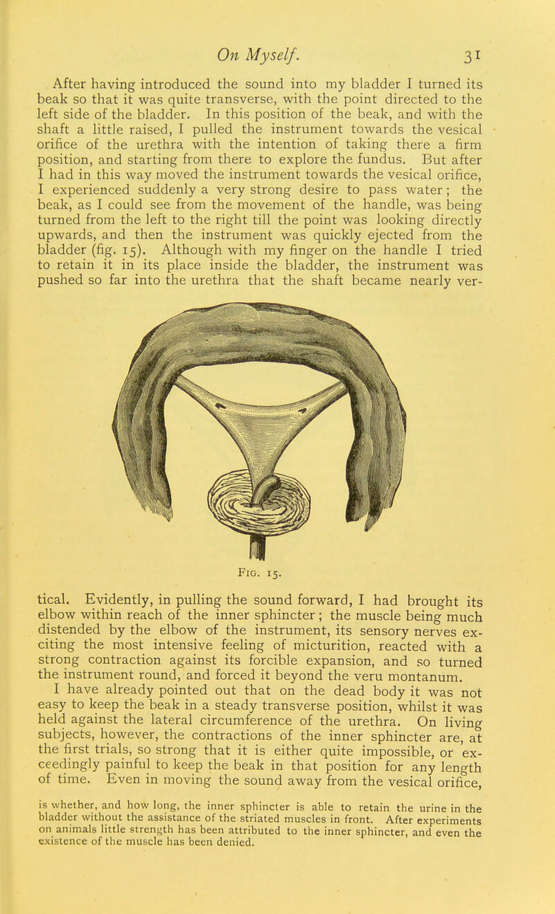 After having introduced the sound into my bladder I turned its beak so that it was quite transverse, with the point directed to the left side of the bladder. In this position of the beak, and with the shaft a little raised, I pulled the instrument towards the vesical orifice of the urethra with the intention of taking there a firm position, and starting from there to explore the fundus. But after I had in this way moved the instrument towards the vesical orifice, I experienced suddenly a very strong desire to pass water; the beak, as I could see from the movement of the handle, was being turned from the left to the right till the point was looking directly upwards, and then the instrument was quickly ejected from the bladder (fig. 15). Although with my finger on the handle I tried to retain it in its place inside the bladder, the instrument was pushed so far into the urethra that the shaft became nearly ver- tical. Evidently, in pulling the sound forward, I had brought its elbow within reach of the inner sphincter ; the muscle being much distended by the elbow of the instrument, its sensory nerves ex- citing the most intensive feeling of micturition, reacted with a strong contraction against its forcible expansion, and so turned the instrument round, and forced it beyond the veru montanum. I have already pointed out that on the dead body it was not easy to keep the beak in a steady transverse position, whilst it was held against the lateral circumference of the urethra. On living subjects, however, the contractions of the inner sphincter are, at the first trials, so strong that it is either quite impossible, or ex- ceedingly painful to keep the beak in that position for any length of time. Even in moving the sound away from the vesical orifice, is whether, and how long, the inner sphincter is able to retain the urine in the bladder without the assistance of the striated muscles in front. After experiments on animals little strength has been attributed to the inner sphincter, and even the existence of the muscle has been denied. Fig. 15.