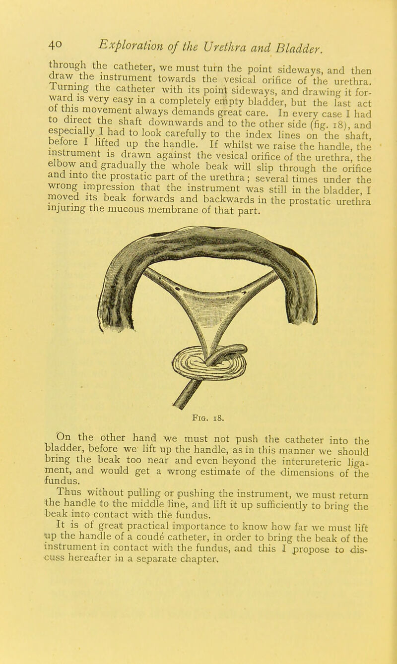 through the catheter, we must turn the point sideways, and then draw the instrument towards the vesical orifice of the urethra. I urning the catheter with its point sideways, and drawing it for- ward is very easy in a completely empty bladder, but the last act ot this movement always demands great care. In every case I had to direct the shaft downwards and to the other side (fig. i8), and especially I had to look carefully to the index lines on the shaft, petore 1 lifted up the handle. If whilst we raise the handle, the instrument is drawn against the vesical orifice of the urethra, the elbow and gradually the whole beak will sHp through the orifice and into the prostatic part of the urethra ; several times under the wrong impression that the instrument was still in the bladder, I moved its beak forwards and backwards in the prostatic urethra injuring the mucous membrane of that part. Fig. i8. On the other hand Vi^e must not push the catheter into the bladder, before we lift up the handle, as in this manner we should bring the beak too near and even beyond the interureteric liga- ment, and would get a wrong estimate of the dimensions of the fundus. Thus without pulling or pushing the instrument, we must return the handle to the middle line, and lift it up sufficiently to bring the beak into contact with the fundus. It is of great practical importance to know how far we must lift up the handle of a coude catheter, in order to bring the beak of the instrument in contact with the fundus, and tJiis I propose to dis- cuss hereafter in a separate chapter-.