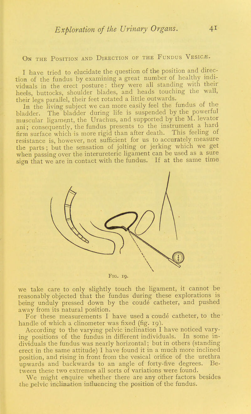 On the Position and Direction of the Fundus Vesicae. I have tried to elucidate the question of the position and direc- tion of the fundus by examining a great number of healthy indi- viduals in the erect posture: they were all standing with their heels, buttocks, shoulder blades, and heads touching the wall, their legs parallel, their feet rotated a little outwards. In the living subject we can more easily feel the fundus of the bladder. The bladder during life is suspended by the powerful muscular ligament, the Urachus, and supported by the M. levator ani; consequently, the fundus presents to the instrument a hard firm surface which is more rigid than after death. This feeling of resistance is, however, not sufficient for us to accurately measure the parts ; but the sensation of jolting or jerking which we get when passing over the interureteric ligament can be used as a sure sign that we are in contact with the fundus. If at the same time Fig. 19. we take care to only slightly touch the ligament, it cannot be reasonably objected that the fundus during these explorations is being unduly pressed down by the coude catheter, and pushed away from its natural position. For these measurements I have used a coude catheter, to the handle of which a clinometer was fixed (fig. 19). According to the varying pelvic inclination I have noticed vary- ing positions of the fundus in different individuals. In some in- dividuals the fundus was nearly horizontal; but in others (standing erect in the same attitude) I have found it in a much more inclined position, and rising in front from the vesical orifice of the urethra upwards and backwards to an angle of forty-five degrees. Be- tween these two extremes all sorts of variations were found. We might enquire whether there are any other factors besides the pelvic inclijaa-tion influencing the position of the fundus.