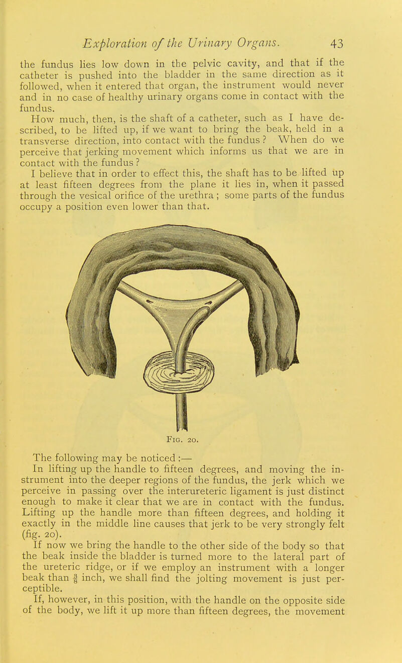the fundus lies low down in the pelvic cavity, and that if the catheter is pushed into the bladder in the same direction as it followed, when it entered that organ, the instrument would never and in no case of healthy urinary organs come in contact with the fundus. How much, then, is the shaft of a catheter, such as I have de- scribed, to be lifted up, if we want to bring the beak, held in a transverse direction, into contact with the fundus ? When do we perceive that jerking movement which informs us that we are in contact with the fundus ? I believe that in order to effect this, the shaft has to be lifted up at least fifteen degrees from the plane it lies in, when it passed through the vesical orifice of the urethra ; some parts of the fundus occupy a position even lower than that. Fig. 20. The following may be noticed :— In lifting up the handle to fifteen degrees, and moving the in- strument into the deeper regions of the fundus, the jerk which we perceive in passing over the interureteric ligament is just distinct enough to make it clear that we are in contact with the fundus. Lifting up the handle more than fifteen degrees, and holding it exactly in the middle line causes that jerk to be very strongly felt (fig. 20). If now we bring the handle to the other side of the body so that the beak inside the bladder is turned more to the lateral part of the ureteric ridge, or if we employ an instrument with a longer beak than | inch, we shall find the jolting movement is just per- ceptible. If, however, in this position, with the handle on the opposite side of the body, we lift it up more than fifteen degrees, the movement