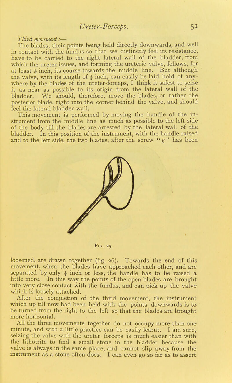 Third movement:— The blades, their points being held directly downwards, and well in contact with the fundus so that we distinctly feel its resistance, have to be carried to the right lateral wall of the bladder, from which the ureter issues, and forming the ureteric valve, follows, for at least ^ inch, its course towards the middle line. But although the valve, with its length of ^ inch, can easily be laid hold of any- where by the blades of the ureter-forceps, I think it safest to seize it as near as possible to its origin from the lateral wall of the bladder. We should, therefore, move the blades, or rather the posterior blade, right into the corner behind the valve, and should feel the lateral bladder-wall. This movement is performed by moving the handle of the in- strument from the middle line as much as possible to the left side of the body till the blades are arrested by the lateral wall of the bladder. In this position of the instrument, with the handle raised and to the left side, the two blades, after the screw  g has been Fig. 25. loosened, are drawn together (fig. 26). Towards the end of this movement, when the blades have approached each other, and are separated by only ^ inch or less, the handle has to be raised a little more. In this way the points of the open blades are brought into very close contact with the fundus, and can pick up the valve which is loosely attached. After the completion of the third movement, the instrument which up till now had been held with the points downwards is to be turned from the right to the left so that the blades are brought more horizontal. All the three movements together do not occupy more than one minute, and with a little practice can be easily learnt. I am sure, seizing the valve with the ureter forceps is much easier than with the lithotrite to find a small stone in the bladder because the valve is always in the same place, and cannot slip away from the instrument as a stone often does. I can even go so far as to assert