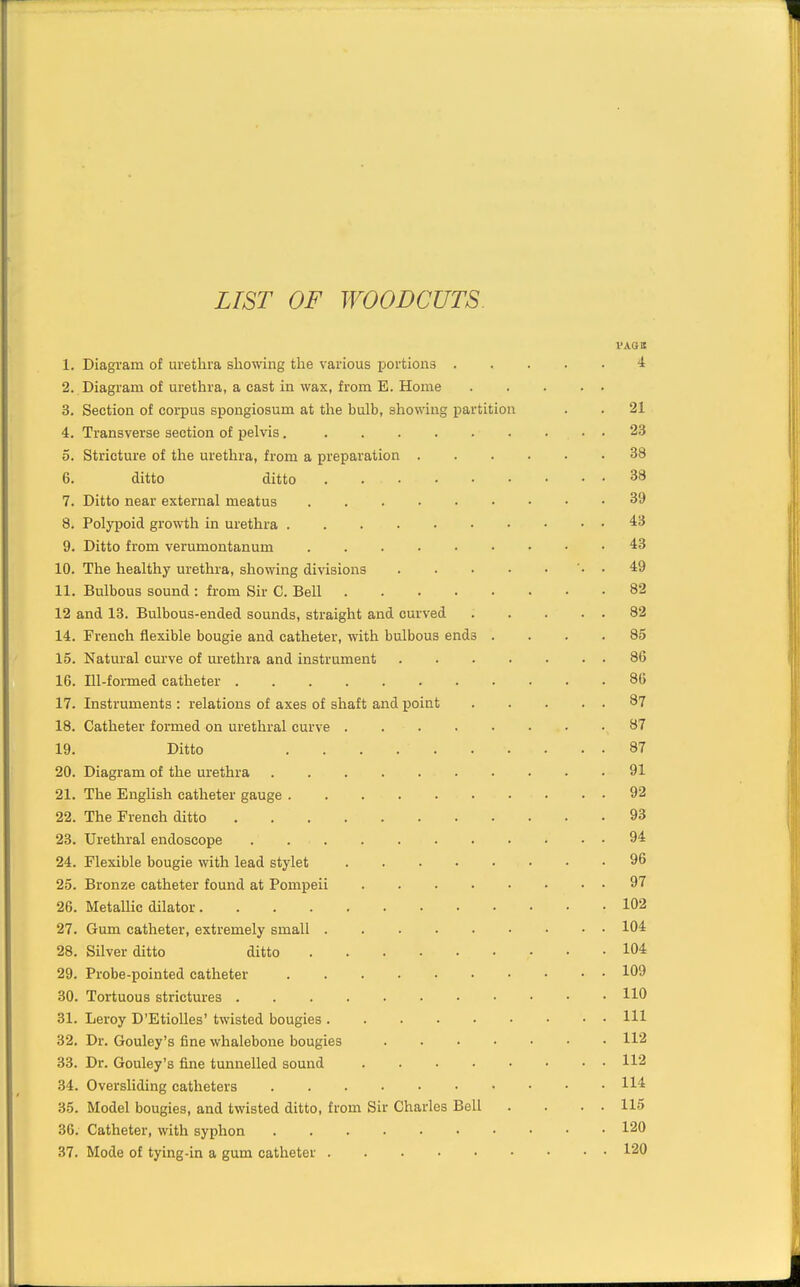 LIST OF WOODCUTS I'AGS 1. Diagram of urethra showing the various portions 4 2. Diagram of urethra, a cast in wax, from E. Home 3. Section of coi-pus spongiosum at the bulb, showing partition . . 21 4. Transverse section of pelvis 23 5. Stricture of the urethra, from a preparation 38 6. ditto ditto 38 7. Ditto near external meatus 39 8. Polypoid growth in urethra ^3 9. Ditto from verumontanum 43 10. The healthy urethra, showing divisions ■. . 49 11. Bulbous sound : from Sir C. Bell 82 12 and 13. Bulbous-ended sounds, straight and curved 82 14. French flexible bougie and catheter, with bulbous ends .... 85 15. Natural curve of urethra and instrument 86 16. Ill-formed catheter 8G 17. Instruments : relations of axes of shaft and point 87 18. Catheter formed on urethral curve 87 19. Ditto 87 20. Diagram of the urethra 91 21. The English catheter gauge 92 22. The French ditto 93 23. Urethral endoscope 94 24. Flexible bougie with lead stylet 96 25. Bronze catheter found at Pompeii 97 26. MetaUic dilator 102 27. Gum catheter, extremely small 104 28. Silver ditto ditto 104 29. Probe-pointed catheter 109 30. Tortuous strictures HO 31. Leroy D'EtioUes' twisted bougies HI 32. Dr. Gouley's fine whalebone bougies 112 33. Dr. Gouley's fine tunnelled sound 112 34. Oversliding catheters 35. Model bougies, and twisted ditto, from Sir Charles Bell . . . . 115 36. Catheter, with syphon 120 37. Mode of tying-in a gum catheter 120