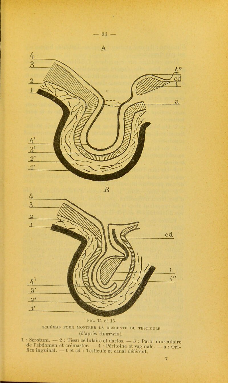 A 4 FiG. 14 et là. 3CIIKMA3 POUn MONTUER LA DESCENTE DU TESTICULE (d'après IIehïwig). 1 : Scrotum. — 2 : Tissu cellulaire et dartos. — 3 : Paroi musculaire df; l'abdomen et crémasler. — 4 : l'éritoinc et va^rinale. — a : Ori- fice Inguinal. — l et cd : Testicule et canal déférent.