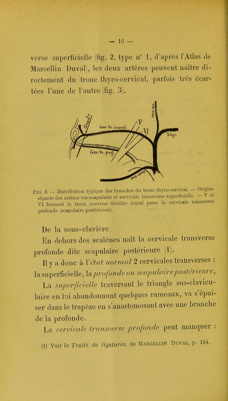 verse superficielle (fig. 2, type n° 1, d'après l'Atlas de Marcellin Du val), les deux artères peuvent naître di- rectement du tronc thyro-cervical, parfois très écar- tées l'une de l'autre (fig. 3). FlG. 3. — Distribution typique des branches du tronc thyro-cervical. — Origine séparée des artères sus-scapulaire et cervicale transverse superficielle. — V et VI forment le tronc nerveux derrière lequel passe la cervicale transverse profonde (scapulaire postérieure). De la sous-clavière En dehors des scalènes naît la cervicale transverse profonde dite scapulaire postérieure (1). Il y a donc à Y état normal 2 cervicales transverses : la superficielle, la profonde ou scapulaire postérieure, La superficielle traversant le triangle sus-clavicu- laire en lui abandonnant quelques rameaux, va s'épui- ser dans le trapèze en s'anastomosant avec une branche de la profonde. La cervicale transverse profonde peut manquer : (1) Voir le Traité de ligatures, de Marcellin Duval, p. 164.