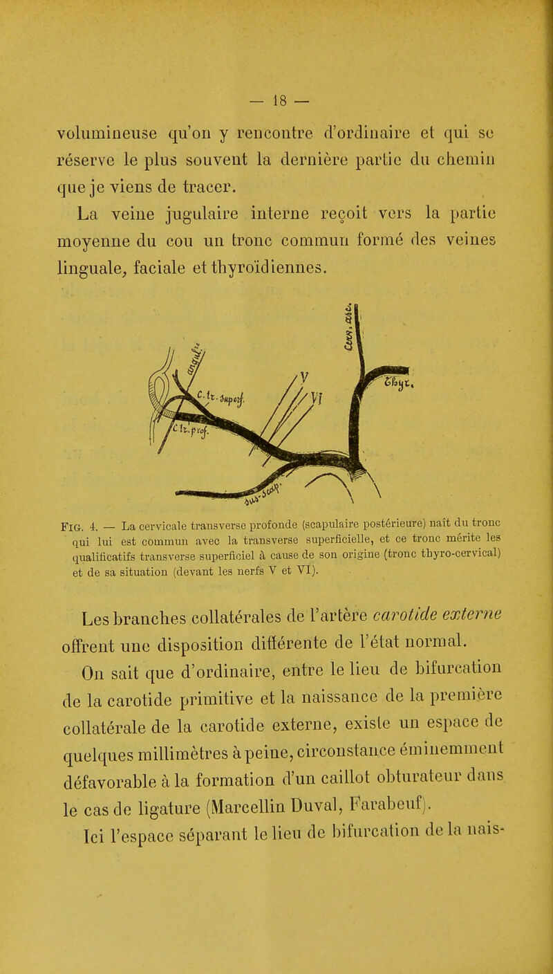 volumineuse qu'on y rencontre d'ordinaire et qui se réserve le plus souvent la dernière partie du chemin que je viens de tracer. La veine jugulaire interne reçoit vers la partie moyenne du cou un tronc commun formé des veines linguale, faciale et thyroïdiennes. Fig. i. — La cervicale transverse profonde (scapulaire postérieure) naît du tronc qui lui est commun avec la transverse superficielle, et ce tronc mérite les qualificatifs transverse superficiel à cause de son origine (tronc thyro-cervical) et de sa situation (devant les nerfs V et VI). Les branches collatérales de l'artère carotide externe offrent une disposition différente de l'état normal. On sait que d'ordinaire, entre le lieu de bifurcation de la carotide primitive et la naissance de la première collatérale de la carotide externe, existe un espace de quelques millimètres à peine, circonstance éminemment défavorable à la formation d'un caillot obturateur dans le cas de ligature (Marcellin Duval, Farabcuf. Ici l'espace séparant le lieu de bifurcation de la nais-