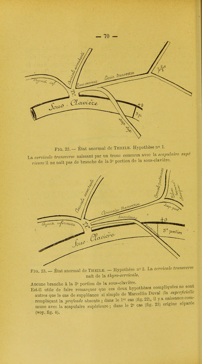 FiG. 22.— État anormal de Theile. Hypothèse n° 1. La cervicale traverse naissant par un tronc commun avec la scapnlairo mpê rienre il ne naît pas de branche de la 3* portion de la sous-clavière. Fig. 23. - État anormal de Theile. - Hypothèse n» 2. La cervicale traverse naît de la thyro-eervicale. Aucune branche à la 3e portion de la sous-clavière. Est-il utile de faire remarquer que ces deux hypothèses comp iquees ne sont autres que le cas de suppléance si simple do Marcellin Duval (la mperjwum remplaçant la profonde absente ; dans le 1 cas (fig. 22), il y a naissance com- mune avec la scapulaire supérieure ; dans le 2-= cas (fig. 23) origine séparée (voy. fig. 4).