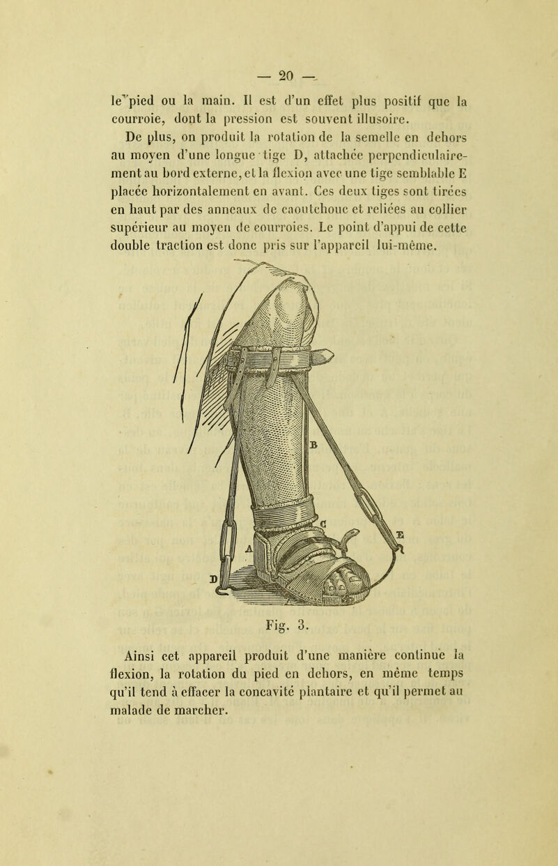 Ie''pied ou la main. Il est d'un effet plus positif que la courroie, dont la pression est souvent illusoire. De plus, on produit la rotation de la semelle en dehors au moyen d'une longue tige D, attachée perpendiculaire- ment au bord externe, et la flexion avec une tige semblable E placée horizontalement en avant. Ces deux tiges sont tirées en haut par des anneaux de caoutchouc et reliées au collier supérieur au moyen de courroies. Le point d'appui de cette double traction est donc pris sur l'appareil lui-même. Fig. 3. Ainsi cet appareil produit d'une manière continue îa flexion, la rotation du pied en dehors, en même temps qu'il tend à effacer la concavité plantaire et qu'il permet au malade de marcher.
