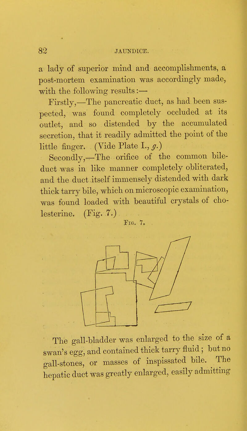 a lady of superior mind and accomplishments, a post-mortem examination was accordingly made, with the following results:— Firstly,—The pancreatic duct, as had been sus- pected, was found completely occluded at its outlet, and so distended by the accumulated secretion, that it readily admitted the point of the little finger. (Vide Plate I., g.) Secondly,---The orifice of the common bile- duct was in like manner completely obliterated, and the duct itself immensely distended with dark thick tarry bile, which on microscopic examination, was found loaded with beautiful crystals of cho- lesterine. (Fig. 7.) Pig. 7. . ' The gall-bladder was enlarged to the size of a swan's egg, and contained thick tarry fluid; but no gall-stones, or masses of inspissated bile. The hepatic duct was greatly enlarged, easily admitting