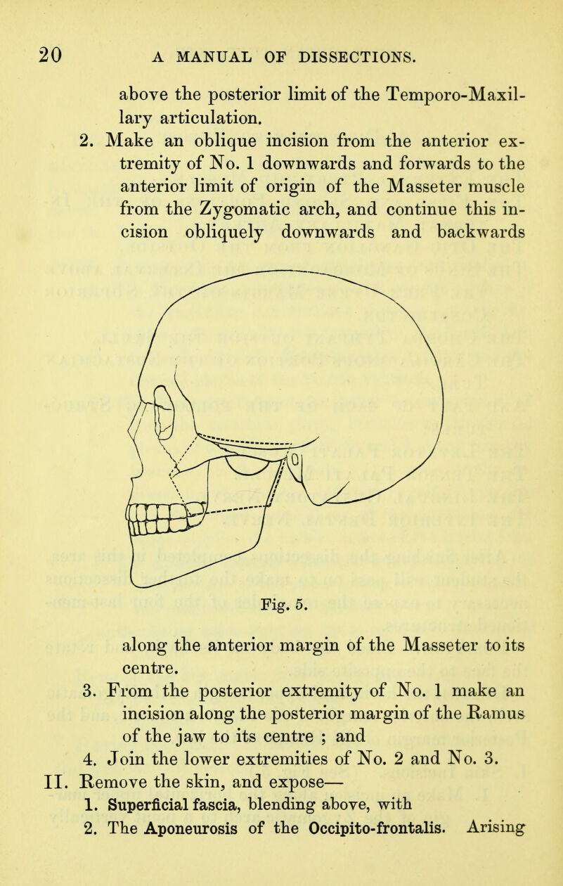 above the posterior limit of the Temporo-Maxil- lary articulation. 2. Make an oblique incision from the anterior ex- tremity of No. 1 downwards and forwards to the anterior limit of origin of the Masseter muscle from the Zygomatic arch, and continue this in- cision obliquely downwards and backwards Fig. 5. along the anterior margin of the Masseter to its centre. 3. From the posterior extremity of No. 1 make an incision along the posterior margin of the Ramus of the jaw to its centre ; and 4. Join the lower extremities of No. 2 and No. 3. II. Remove the skin, and expose— 1. Superficial fascia, blending above, with 2. The Aponeurosis of the Occipito-frontalis. Arising