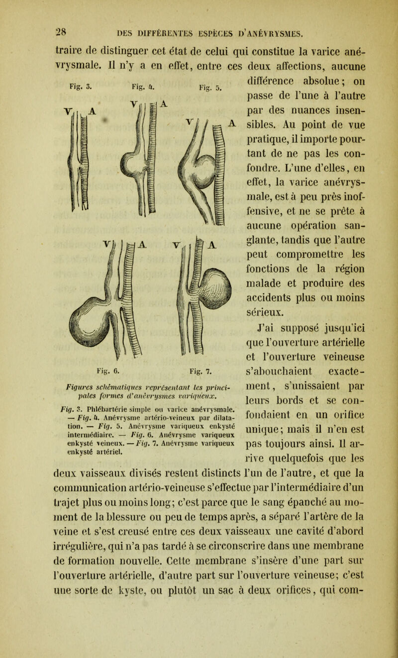 Fie:. 3. Fig. a. Fig. traire de distinguer cet état de celui qui constitue la varice ané- vrysmale. Il n'y a en effet, entre ces deux affections, aucune différence absolue ; on passe de l'une à l'autre par des nuances insen- sibles. Au point de vue pratique, il importe pour- tant de ne pas les con- fondre. L'une d'elles, en effet, la varice anévrys- male, est à peu près inof- fensive, et ne se prête à aucune opération san- glante, tandis que l'autre peut compromettre les fonctions de la région malade et produire des accidents plus ou moins sérieux. J'ai supposé jusqu'ici que l'ouverture artérielle et l'ouverture veineuse s'abouchaient exacte- ment , s'unissaient par leurs bords et se con- fondaient en un orifice unique ; mais il n'en est pas toujours ainsi. Il ar- rive quelquefois que les deux vaisseaux divisés restent distincts l'un de l'autre, et que la communication artério-veineuse s'effectue par l'intermédiaire d'un trajet plus ou moins long; c'est parce que le sang épanché au mo- ment de la blessure ou peu de temps après, a séparé l'artère de la veine et s'est creusé entre ces deux vaisseaux une cavité d'abord irrégulière, qui n'a pas tardé à se circonscrire dans une membrane de formation nouvelle. Cette membrane s'insère d'une part sur l'ouverture artérielle, d'autre part sur l'ouverture veineuse; c'est une sorte de kyste, ou plutôt un sac à deux orifices, qui com- Fig. 6. Fig. 7. Figures schématiques représentant les princi- pales formes cl'anèvrysynes variqueux. Fig- S. Phlébartérie simple ou varice anévrysmale. — Fig. U. Anévrysme artério-veineux par dilata- tion. — Fig. 5. Anévrysme variqueux enkysté intermédiaire. — Fig. 6. Anévrysme variqueux enkysté veineux. — Fig. 7. Anévrysme variqueux enkysté artériel.