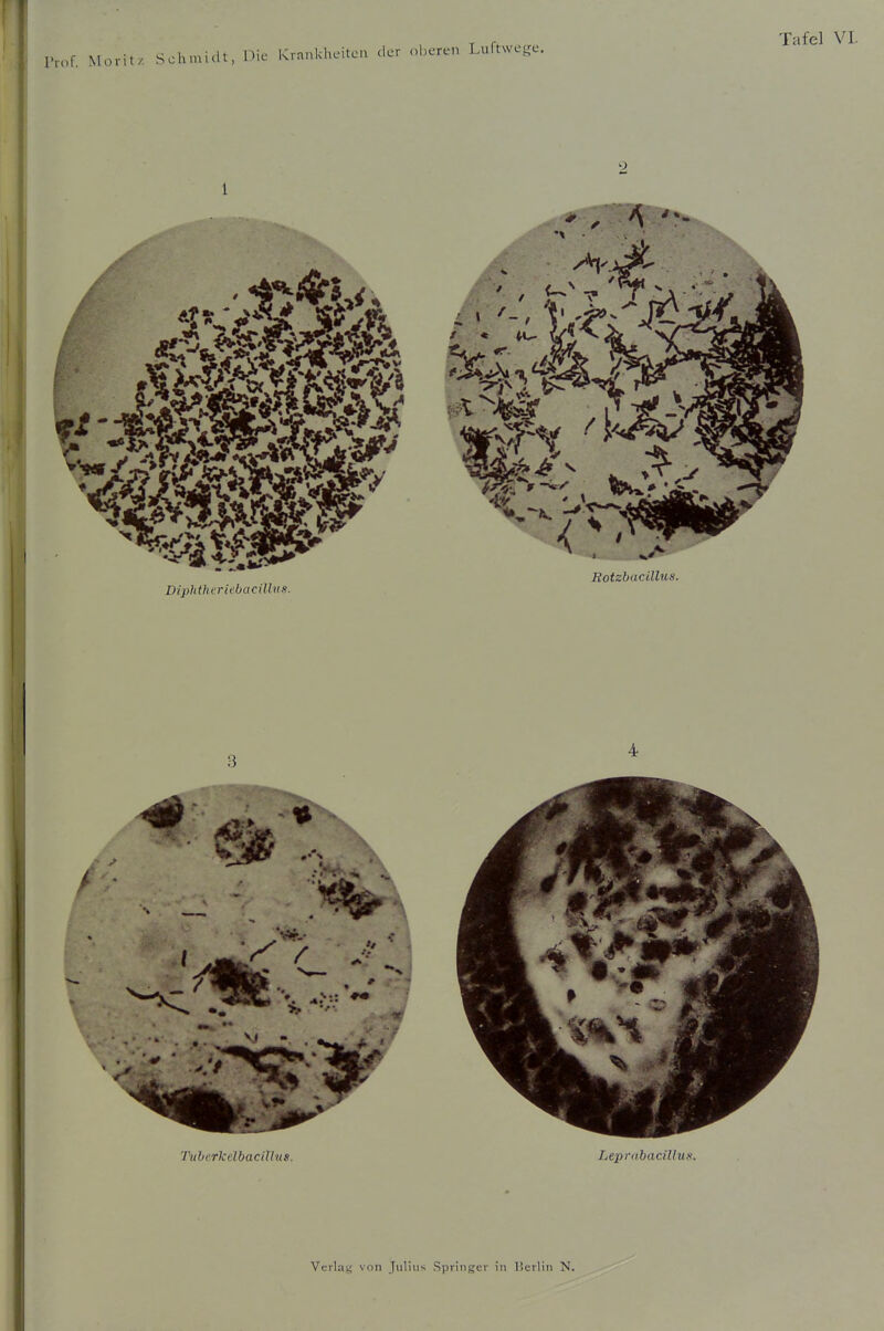 riof. Mo ritz 2 1 Rotzbucillus. Diphtheriebacilhts.
