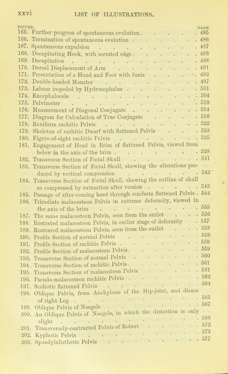 FIGURE. 165. Further progress of spontaneous evolution. 166. Termination of spontaneous evolution . 167. Spontaneous expulsion .... 168. Decapitating Hook, with serrated edge. 169. Decapitation 170. Dorsal Displacement of Arm 171. Presentation of a Hand and Foot with funis 172. Double-headed Monster .... 173. Labour impeded by Hydrocephalus . 174. Encepbalocele 175. Pelvimeter ...... 176. Measurement of Diagonal Conjugate 177. Diagram for Calculation of True Conjugate 178. Reniform rachitic Pelvis .... 179. Skeleton of rachitic Dwarf with flattened Pelvis 180. Figure-of-eight rachitic Pelvis 181. Engagement of Head in Brim of flattened Pelvis, viewed from below in the axis of the brim 182. Transverse Section of Foetal Skull 183. Transverse Section of Foetal Skull, showing the alterations pro- duced by vertical compression ..... 184. Transverse Section of Fcetal Skull, showing the outline of skull as compressed by extraction after version 185. Passage of after-coming head through reniform flattened Pelvis . 186. Triradiate malacosteon Pelvis in extreme deformity, viewed in the axis of the brim 187< The same malacosteon Pelvis, seen from the outlet . . . 188. Rostrated malacosteon Pelvis, in earlier stage of deformity 189. Rostrated malacosteon Pelvis, seen from the outlet . . . 190. Profile Section of normal Pelvis 191. Profile Section of rachitic Pelvis 192. Profile Section of malacosteon Pelvis 193. Transverse Section of normal Pelvis 194. Transverse Section of rachitic Pelvis. 195. Transverse Section of malacosteon Pelvis 196. Pseudo-malacosteon rachitic Pelvis 197. Scoliotic flattened Pelvis * ' 198. Oblique Pelvis, from Anchylosis of the Hip-joint, and disuse of right Leg ..•»** 199. Oblique Pelvis of Naegele 200. An Oblique Pelvis of Naegele, in which the distortion is only slight 201. Transversely-contracted Pelvis of Robert 202. Kyphotic Pelvis 203. Spondylolisthetic Pelvis . PAGE 485 486 487 488 488 491 492 497 501 504 510 514 516 522 523 525 528 541 542 543 544 555 556 557 558 559 559 559 560 561 561 562 564 565 567 568 572 573 577