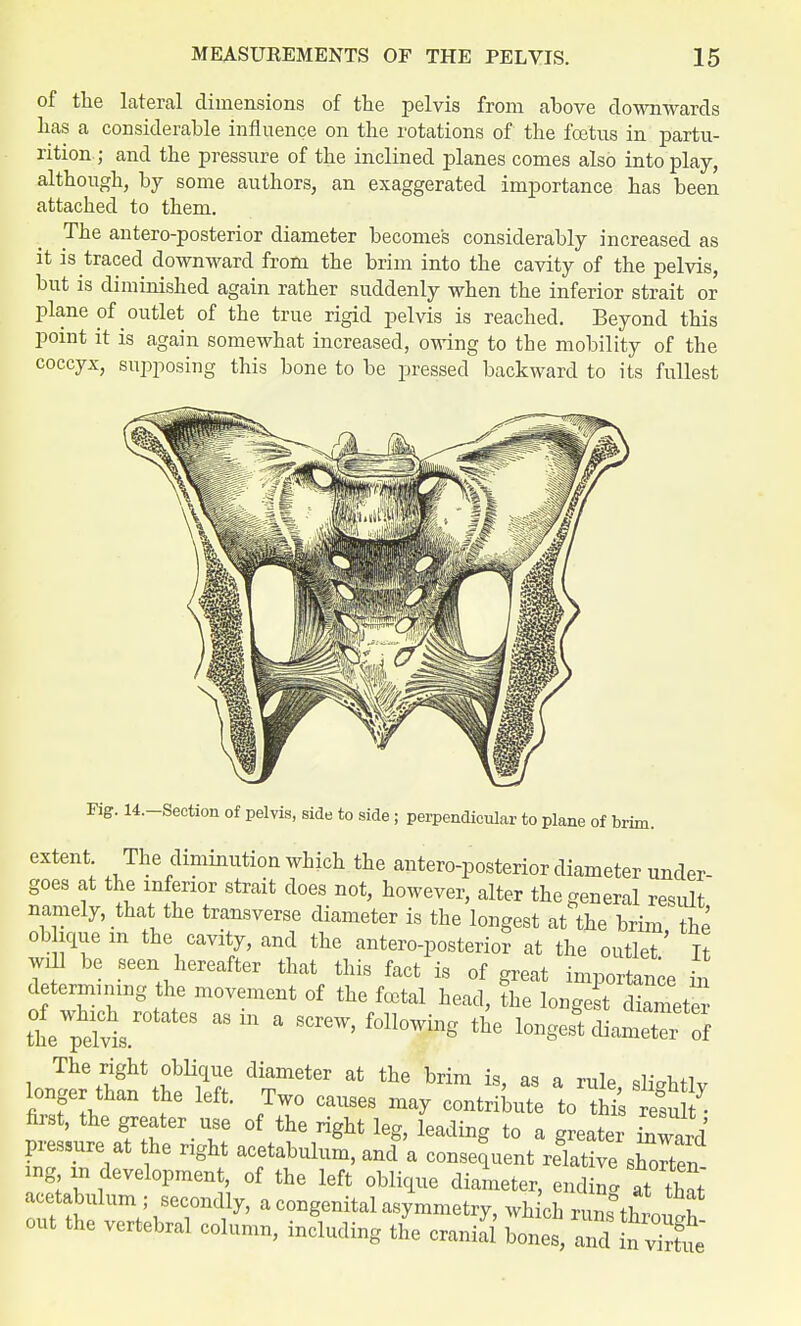 of the lateral dimensions of the pelvis from above downwards has a considerable influence on the rotations of the foetus in partu- rition; and the pressure of the inclined planes conies also into play, although, by some authors, an exaggerated importance has been attached to them. The antero-posterior diameter becomes considerably increased as it is traced downward from the brim into the cavity of the pelvis, but is diminished again rather suddenly when the inferior strait or plane of outlet of the true rigid pelvis is reached. Beyond this point it is again somewhat increased, owing to the mobility of the coccyx, supposing this bone to be pressed backward to its fullest Fig. 14.-Section of pelvis, side to side; perpendicular to plane of brim. extent The diminution which the antero-posterior diameter under- goes at the inferior strait does not, however, alter the general result namely, that the transverse diameter is the longest at the brim the ob ique m the cavity, and the antero-posterior at the outlet' It will be seen hereafter that this fact is of great importance rn determining the movement of the foetal head, the longest diamete thesis ' SCieW' f°ll0Wing the 1-SesUliametTr S The right oblique diameter at the brim is, as a rule sUehtlv longer than the left. Two causes may contribute 3 first, the greater use of the right leg, leading to a greater iltll pressure at the right acetabulum, and a consequent refative £ ng m development, of the left oblique diameter, ending at Zl acetabulum ; secondly, a congenital asymmetry, which runfthLll out the vertebral column, including tl crania} 5£S£35£