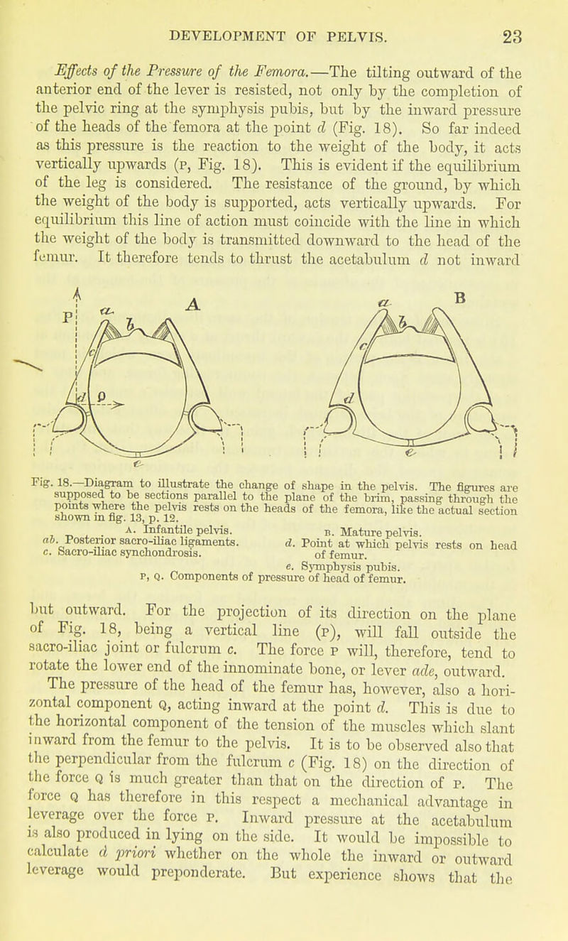 Effects of the Pressure of the Femora.—The tilting outward of the anterior end of the lever is resisted, not only by the completion of the pelvic ring at the symphysis pubis, but by the inward pressure of the heads of the femora at the point d (Fig. 18). So far indeed as this pressure is the reaction to the weight of the body, it acts vertically upwards (p, Fig. 18). This is evident if the equilibrium of the leg is considered. The resistance of the ground, by which the weight of the body is supported, acts vertically upwards. For equilibrium this line of action must coincide with the line in which the weight of the body is transmitted downward to the head of the femur. It therefore tends to thrust the acetabulum d not inward Fig. 18.—Diagram to illustrate the change of shape in the pelvis. The figures are supposed to be sections parallel to the plane of the brim, passing through the points where the pelvis rests on the heads of the femora, like the actual section shown in fig. 13, p. 12. _ —_ , . A- Infantile pelvis. b. Mature pelvis. ab. Posterior sacro-ihac ligaments. d. Point at which pelvis rests on head c. Sacro-iliac synchondrosis. of femur. e. Symphysis pubis, p, Q. Components of pressure of head of femur. but outward. For the projection of its direction on the plane of Fig. 18, being a vertical line (p), will fall outside the sacro-iliac joint or fulcrum c. The force p will, therefore, tend to rotate the lower end of the innominate bone, or lever ade, outward. The pressure of the head of the femur has, however, also a hori- zontal component q, acting inward at the point d. This is due to the horizontal component of the tension of the muscles which slant inward from the femur to the pelvis. It is to be observed also that the perpendicular from the fulcrum c (Fig. 18) on the direction of the force q is much greater than that on the direction of p. The force q has therefore in this respect a mechanical advantage in leverage over the force p. Inward pressure at the acetabulum is also produced in lying on the side. It would be impossible to calculate d priori whether on the whole the inward or outward leverage would preponderate. But experience shows that the