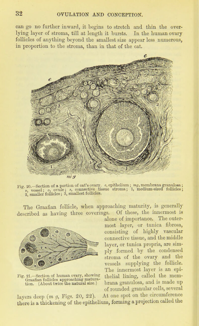 can go no further inward, it begins to stretch and thin the over- lying layer of stroma, till at length it bursts. In the human ovary follicles of anything beyond the smallest size appear less numerous, in proportion to the stroma, than in that of the cat. Fig 20.—Section of a portion of cat's ovary, e, epithelium; mg, membrana granulosa; v Vessel- o, ovule; s, connective tissue stroma; 1, medium-sized follicles; 2, smaller follicles; 3, smallest follicles. The Graafian follicle, when approaching maturity, is generally described as having three coverings. Of these, the innermost is alone of importance. The outer- most layer, or tunica fibrosa, consisting of highly vascular connective tissue, and the middle layer, or tunica propria, are sim- ply formed by the condensed stroma of the ovary and the vessels supplying the follicle. The imiermost layer is an epi- thelial lining, called the mem- brana granulosa, and is made up of rounded granular cells, several layers deep (m g, Figs. 20, 22). At one spot on the circumference there is a thickening of the epithelium, forming a projection called the Fig. 21.—Section of human ovary, showing Graafian follicles approaching matura- tion. (About twice the natural size.)