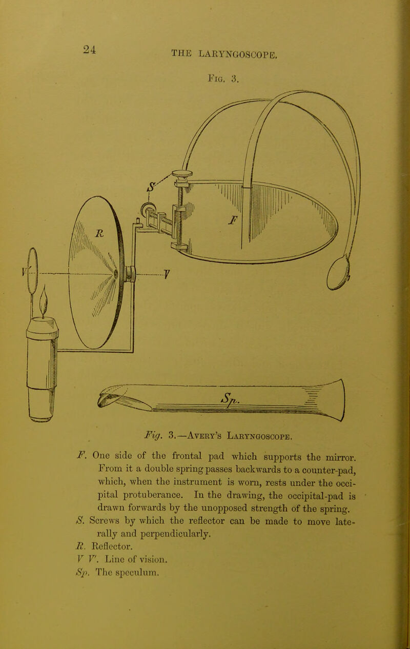 Fig. 3. Fig. 3.—Avery's Laryngoscope. F. One side of the frontal pad which supports the mirror. From it a double spring passes backwards to a counter-pad, which, when the instrument is worn, rests under the occi- pital protuberance. In the drawing, the occipital-pad is drawn forwards by the unopposed strength of the spring. S. Screws by which the reflector can be made to move late- rally and perpendicularly. R. Reflector. V V. Line of vision. /S[p. The speculum.