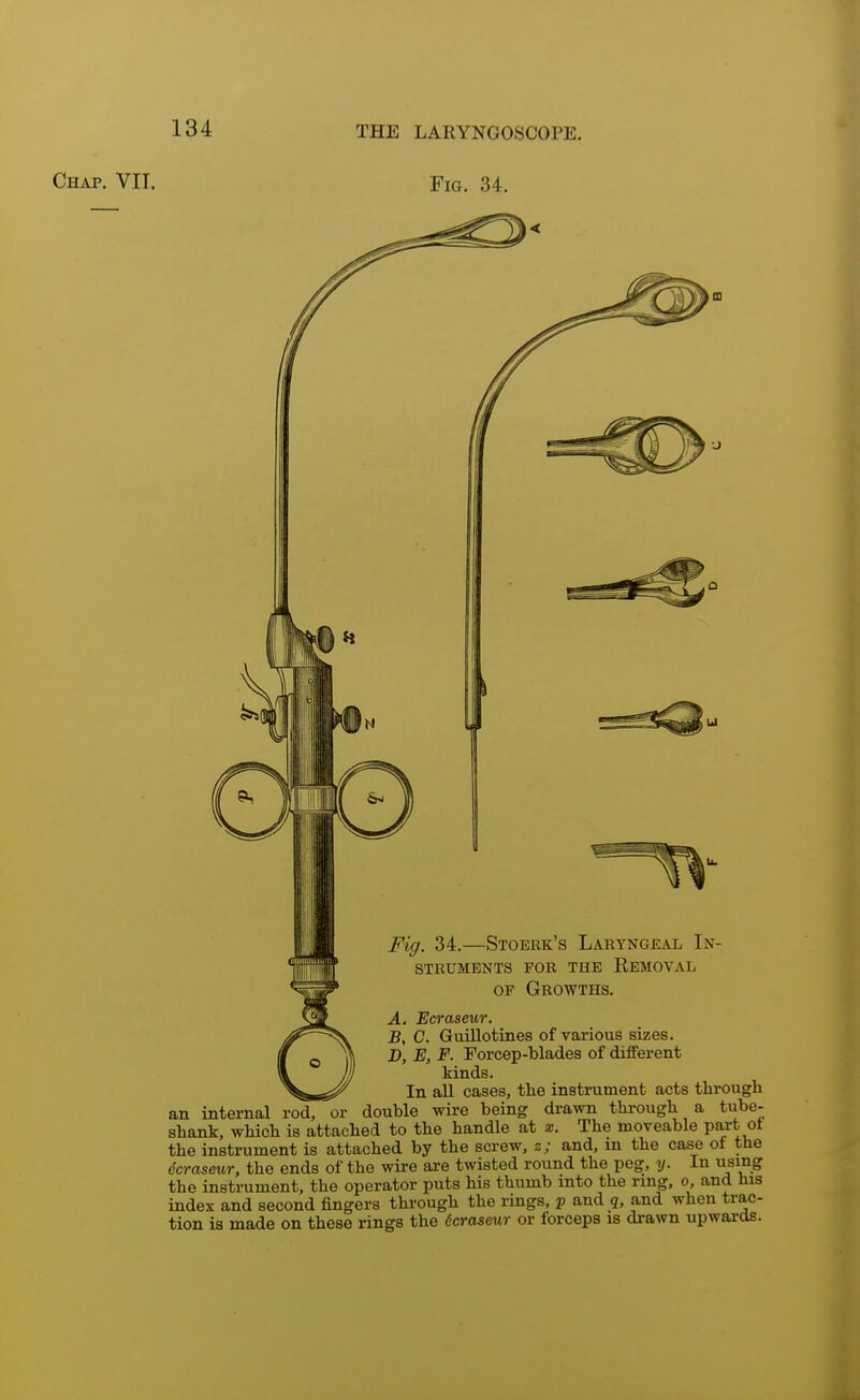 Chap. VII. Fig. 34. Fig. 34.—Stoebk's Laryngeal In- struments for the Removal of Growths. A. Ecraseur. B, C. Guillotines of various sizes. D, E, F. Forcep-blades of different kinds. In all cases, the instrument acts through an internal rod, or double wire being drawn through a tube- shank, which is attached to the handle at x. The moveable part ot the instrument is attached by the screw, s; and, m the case of the dcraseur, the ends of the wire are twisted round the peg, y. In using the instrument, the operator puts his thumb into the ring, o, and his index and second fingers through the rings, p and q, and when trac- tion is made on these rings the dcraseur or forceps is drawn upwards.