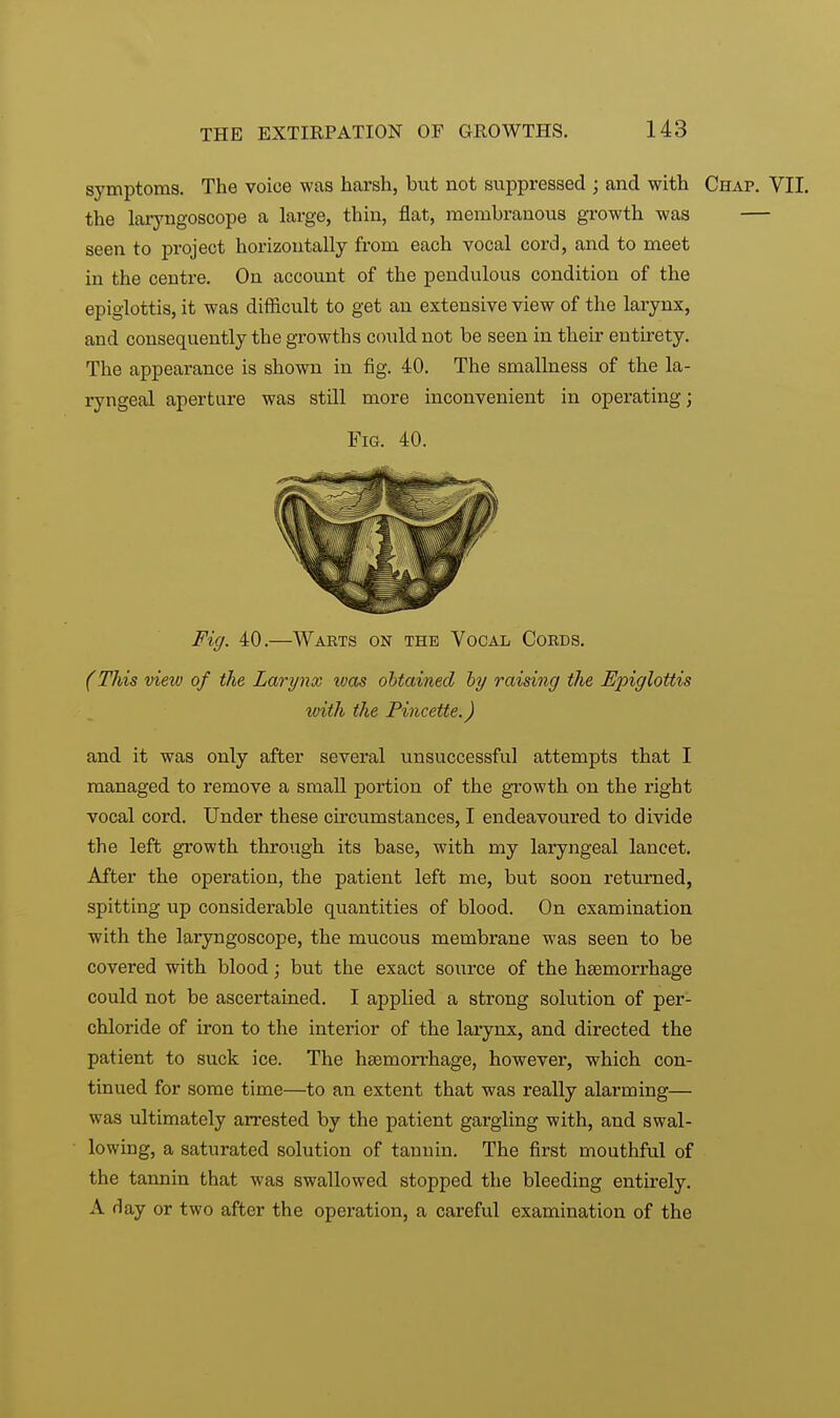 symptoms. The voice was harsh, but not suppressed ; and with Chap. VII. the laryngoscope a large, thin, flat, membranous growth was — seen to project horizontally from each vocal cord, and to meet in the centre. On account of the pendulous condition of the epiglottis, it was difficult to get an extensive view of the larynx, and consequently the growths could not be seen in their entirety. The appearance is shown in fig. 40. The smallness of the la- ryngeal aperture was still more inconvenient in operating; Fig. 40. Fig. 40.—Warts on the Vocal Cords. (This view of the Larynx was obtained by raising the Epiglottis with the Pincette.) and it was only after several unsuccessful attempts that I managed to remove a small portion of the growth on the right vocal cord. Under these circumstances, I endeavoured to divide the left growth through its base, with my laryngeal lancet. After the operation, the patient left me, but soon returned, spitting up considerable quantities of blood. On examination with the laryngoscope, the mucous membrane was seen to be covered with blood; but the exact source of the hemorrhage could not be ascertained. I applied a strong solution of per- chloride of iron to the interior of the larynx, and directed the patient to suck ice. The haemorrhage, however, which con- tinued for some time—to an extent that was really alarming— was ultimately arrested by the patient gargling with, and swal- lowing, a saturated solution of tannin. The first mouthful of the tannin that was swallowed stopped the bleeding entirely. A day or two after the operation, a careful examination of the