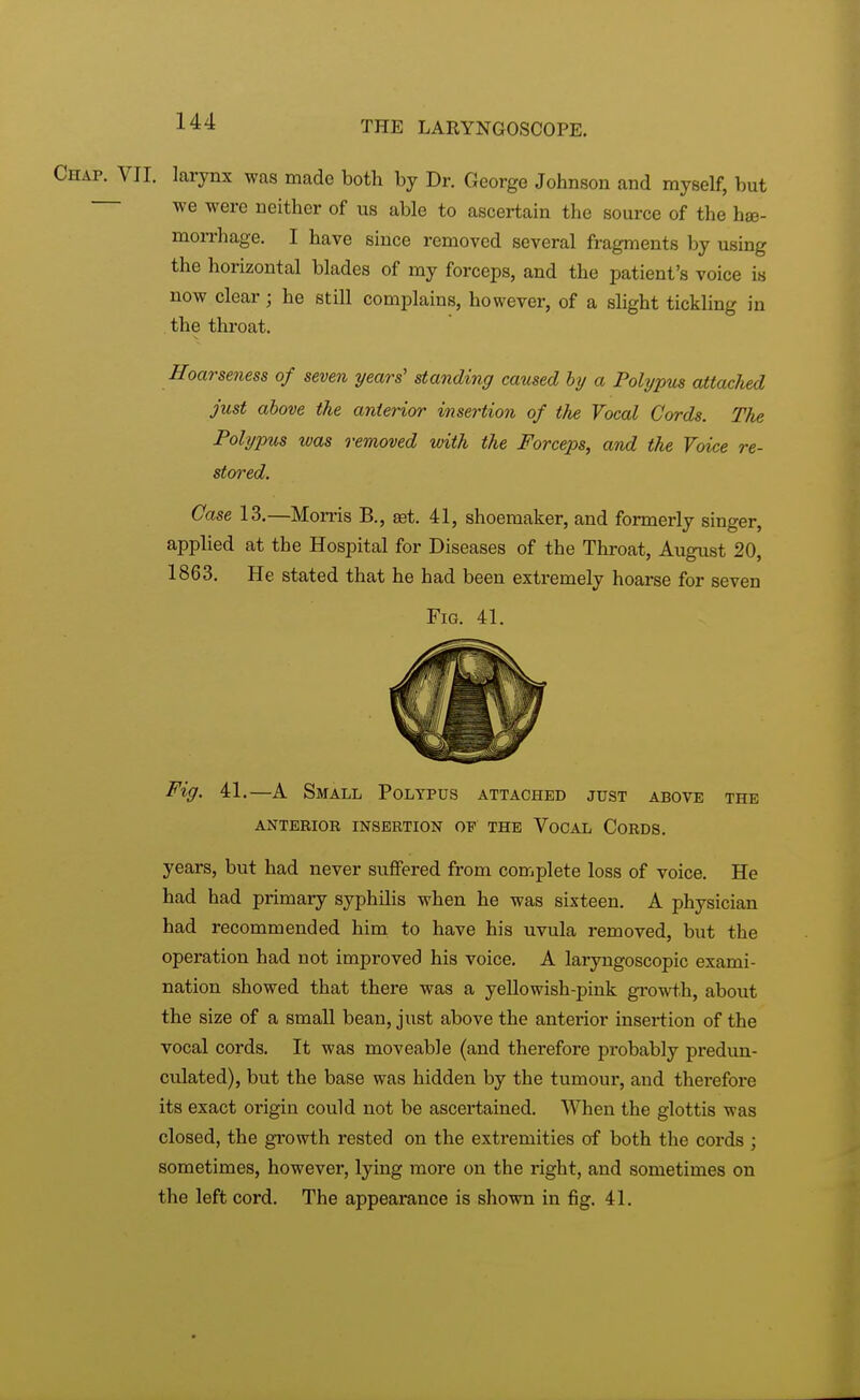 . VII. larynx was made both by Dr. George Johnson and myself, but we were neither of us able to ascertain the source of the hae- morrhage. I have since removed several fragments by using the horizontal blades of my forceps, and the patient's voice is now clear; he still complains, however, of a slight tickling in the throat. Hoarseness of seven years' standing caused by a Polypus attached just above the anterior insertion of the Vocal Cords. T/ie Polypus was removed with the Forceps, and the Voice re- stored. Case 13.—Morris B., set. 41, shoemaker, and formerly singer, applied at the Hospital for Diseases of the Throat, August 20, 1863. He stated that he had been extremely hoarse for seven Fig. 41. Fig. 41.—A Small Polypus attached just above the ANTERIOR INSERTION OF THE VOCAL CORDS. years, but had never suffered from complete loss of voice. He had had primary syphilis when he was sixteen. A physician had recommended him to have his uvula removed, but the operation had not improved his voice. A laryngoscopic exami- nation showed that there was a yellowish-pink growth, about the size of a small bean, just above the anterior insertion of the vocal cords. It was moveable (and therefore probably pedun- culated), but the base was hidden by the tumour, and therefore its exact origin could not be ascertained. When the glottis was closed, the growth rested on the extremities of both the cords ; sometimes, however, lying more on the right, and sometimes on the left cord. The appearance is shown in fig. 41.