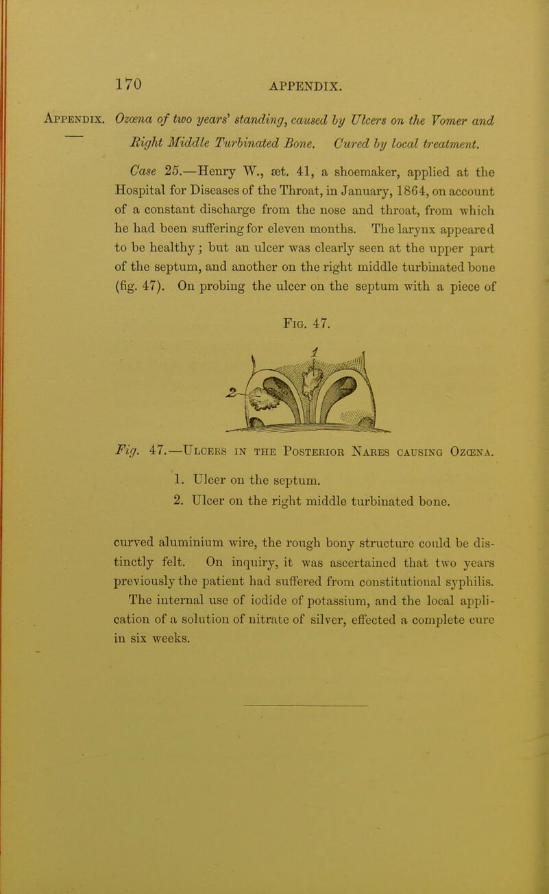 Appendix. Ozoena of two years> standing, caused by Ulcers on the Vomer and Right Middle Turbinated Bone. Cured by local treatment. Case 25.—Henry W., set. 41, a shoemaker, applied at the Hospital for Diseases of the Throat, in January, 1864, on account of a constant discharge from the nose and throat, from which he had been suffering for eleven months. The larynx appeared to be healthy; but an ulcer was clearly seen at the upper part of the septum, and another on the right middle turbinated bone (fig. 47). On probing the ulcer on the septum with a piece of Fig. 47. Fig. 47.—Ulcers in the Posterior Nares causing Oz<ena. 1. Ulcer on the septum. 2. Ulcer on the right middle turbinated bone. curved aluminium wire, the rough bony structure could be dis- tinctly felt. On inquiry, it was ascertained that two years previously the patient had suffered from coustitutioual syphilis. The internal use of iodide of potassium, and the local appli- cation of a solution of nitrate of silver, effected a complete cure in six weeks.