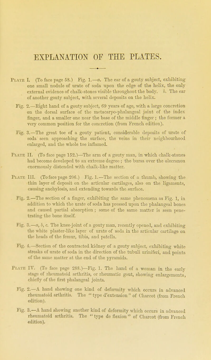 EXPLANATION OF THE PLATES. Plate I. (To face page 58.) Fig. 1.—a. The ear of a gouty subject, exliibiting one small nodule of urate of soda upon the edge of the helix, the only external e'N'idence of chalk-stones visible throughout the body. b. The ear of another gouty subject, with several deposits on the helix. rig. 2.—Right hand of a gouty subject, 69 years of age, with a large concretion on the dorsal surface of the metacarpo-phalangeal joint of the index linger, and a smaller one near the base of the middle finger ; the former a veiy common position for the concretion (fi'om French edition). Fig. 3.—The great toe of a gouty patient, considerable deposits of urate of soda seen approaching the surface, the veins in their neighbourhood enlai'ged, and the whole toe inflamed. Plate II. (To face page 152.)—The arm of a gouty man, in which chalk-stones had become developed to an extreme degree ; the bursa over the olecranon enormously distended with chalk-like matter. Plate III. (To face page 206.) Fig. 1.—The section of a thumb, showing the thin layer of deposit on the articular cartilages, also on the ligaments, causing anchylosis, and extending towards the surface. Fig. 2.—The section of a finger, exhibiting the same phenomena as Fig. 1, in addition to which the urate of soda has jiressed upon the phalangeal bones and caused partial absoi-ption ; some of the same matter is seen pene- trating the bone itself. Fig. 3.—a, b, c. The knee-joint of a gouty man, recently opened, and exhibiting the white plaster-like layer of urate of soda in the articular cartilage on the heads of the femur, tibia, and patella. Fig. 4.—Section of the contracted kidney of a goutj' subject, exhibiting white streaks of urate of soda in the direction of the tubidi luiniferi, and points of the same matter at the end of the pyramids. Plate IV. (To face page 288.)—Fig. 1. The hand of a woman in the early .stage of rheumatoid arthritis, or rheumatic gout, showing enlargements, chiefly of the first phalangeal joints. Fig. 2.—A hand showing one kind of deformity which occurs in advanced rheumatoid arthritis. The  type d'extension  of Charcot (from French edition). 3.—A hand showing another kind of deformity which occurs in advanced rheumatoid arthritis. The type do flexion of Charcot (from French edition).