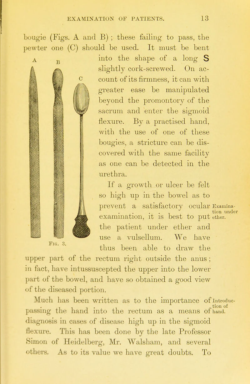 bougie (Figs. A and B) ; these failing to pass, the pewter one (C) should be used. It must be bent into the shape of a long S slightly cork-screwed. On ac- count of its firmness, it can with greater ease be manipulated beyond the promontory of the sacrum and enter the sigmoid flexure. By a practised hand, with the use of one of these bougies, a stricture can be dis- covered with the same faciUty as one can be detected in the urethra. If a growth or ulcer be felt so high up in the bowel as to prevent a satisfactory ocular Examina- tion under exammation, it is best to put ether, the patient under ether and use a vulsellum. We have thus been able to draw the upper part of the rectum right outside the anus; in fact, have intussuscepted the upper into the lower part of the bowel, and have so obtained a good view of the diseased portion. Much has been written as to the importance of introduc- ... tion of passing the hand into the rectum as a means oi hand, diagnosis in cases of disease high up in the sigmoid flexure. This has been done by the late Professor Simon of Heidelberg, Mr. Walsham, and several others. As to its value we have great doubts. To