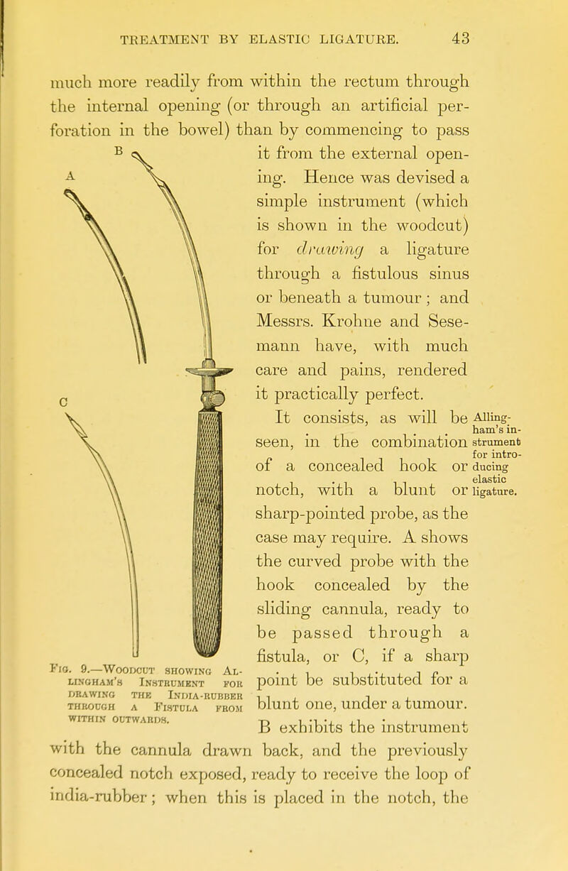 much more readily from within the rectum through the internal opening (or through an artificial per- foration in the bowel) than by commencing to pass it from the external open- ing. Hence was devised a simple instrument (which is shown in the woodcut) for drawing a ligature throug'h a fistulous sinus or beneath a tumour ; and Messrs. Krohne and Sese- mann have, with much care and pains, rendered it practically perfect. It consists, as will be Aiimg- ham's in- seen, in the combination strument of a concealed hook or ducing - . , . - elastic notch, With a blunt or ligature, sharp-pointed probe, as the case may require. A shows the curved probe with the hook concealed by the sliding cannula, ready to be passed through a fistula, or C, if a sharp point be substituted for a blunt one, under a tumour. B exhibits the instrument with the cannula drawn back, and the previously concealed notch exposed, ready to receive the loop of india-rubber; when this is placed in the notch, the Al- FOR Fio. 9.—Woodcut showing linoham's Instrument DRAWING THE IndIA-RUBBER THROUGH A FlSTULA FROM WITHIN OUTWARDS.