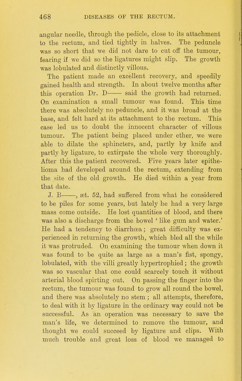 angular needle, through the pedicle, close to its attachment to the rectum, and tied tightly in halves. The peduncle was so short that we did not dare to cut oif the tumour, fearing if we did so the ligatures might slip. The growth was lobulated and distinctly villous. The patient made an excellent recovery, and speedily gained health and strength. In about twelve months after this operation Dr. D said the growth had returned. On examination a small tumour was found. This time there was absolutely no peduncle, and it was broad at the base, and felt hard at its attachment to the rectum. This case led us to doubt the innocent character of villous tumour. The patient bemg placed under ether, we were able to dilate the sphincters, and, partly by knife and partly by ligature, to extirpate the whole very thoroughly. After this the patient recovered. Five years later epithe- lioma had developed around the rectum, extending from the site of the old growth. He died within a year from that date. J. B , set. 52, had suffered from what he considered to be piles for some years, but lately he had a very large mass come outside. He lost quantities of blood, and there was also a discharge from the bowel ' like gum and water.' He had a tendency to diarrhoea; great difficulty was ex- perienced in returning the growth, which bled all the while it was protruded. On examining the tumour when down it was found to be quite as large as a man's fist, spongy, lobulated, with the villi greatly hypertrophied; the growth was so vascular that one could scarcely touch it without arterial blood spirting out. On passing the finger into the rectum, the tumour was found to grow all round the bowel, and there was absolutely no stem ; all attempts, therefore, to deal with it by ligature in the ordinary way could not be successful. As an operation was necessary to save the man's life, we determined to remove the tumour, and thought we could succeed by ligature and clips. With much trouble and great loss of blood we managed to