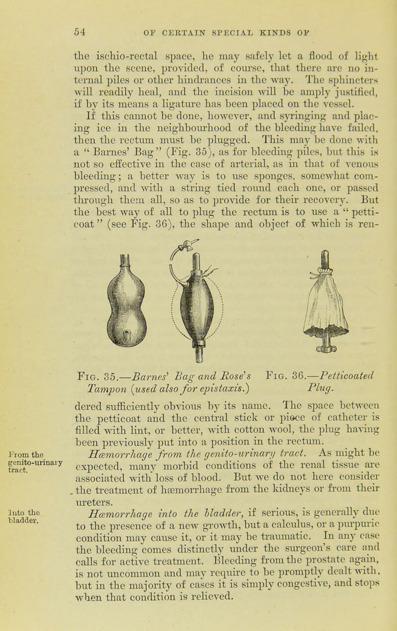 From the gemto-urinary tract. Into the bladder. the ischio-rectal space, he may safely let a flood of light upon the scene, provided, of course, that there are no in- ternal piles or other hindrances in the way. The sphincters will readily heal, and the incision will be amply justified, if by its means a ligature has been placed on the vessel. If this cannot he done, however, and syringing and plac- ing ice in the neighbourhood of the bleeding have failed, then the rectum must be plugged. This may be done with a “ Barnes’ Bag” (Fig. 35), as for bleeding piles, but this is not so effective in the case of arterial, as in that of venous bleeding; a better way is to use sponges, somewhat com- pressed, and with a string tied round each one, or passed through them all, so as to provide for their recovery. But the best way of all to plug the rectum is to use a “ petti- coat ” (see Fig. 36), the shape and object of which is ren- Fig. 35.—Barnes' Bag and Rose's Fig. 36.—Petticoated Tampon [used also for epistaxis.) Plug. dered sufficiently obvious by its name. I he space between the petticoat and the central stick or pioce of catheter is filled with lint, or better, with cotton wool, the plug having been previously put into a position in the rectum. Hcemorrhage from the genito-urinarg tract. As might be expected, many morbid conditions of the renal tissue are associated with loss of blood. But we do not here consider . the treatment of haemorrhage from the kidneys or from their ureters. Hcemorrhage into the bladder, if serious, is generally due to the presence of a new growth, hut a calculus, or a purpuric condition may cause it, or it may be traumatic. In any case the bleeding comes distinctly under the surgeon’s care and calls for active treatment. Bleeding from the prostate again, is not uncommon and may require to be promptly dealt with, but in the majority of cases it is simply congestive, and stops when that condition is relieved.