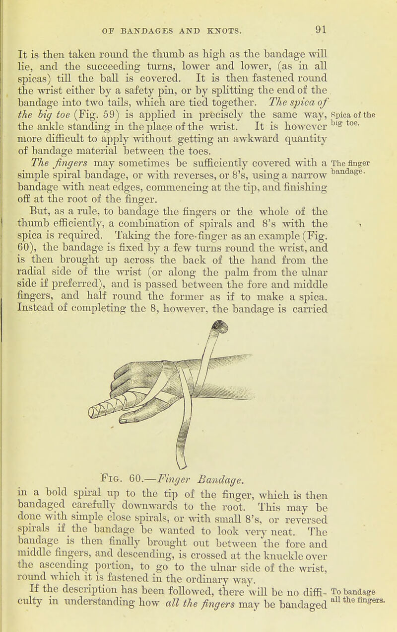 It is then taken round the thumb as high as the bandage will lie, and the succeeding tons, lower and lower, (as in all spicas) till the ball is covered. It is then fastened round the wrist either by a safety pin, or by splitting the end of the bandage into two tails, which are tied together. The spica of the big toe (Fig. 59) is applied in precisely the same way, spica of the the ankle standing- in the place of the wrist. It is however bl° toe- more difficult to apply without getting an awkward quantity of bandage material between the toes. The fingers may sometimes be sufficiently covered with a The finger simple spiral bandage, or with reverses, or 8’s, using a narrow baudage' bandage with neat edges, commencing at the tip, and finishing off at the root of the finger. But, as a ride, to bandage the fingers or the whole of the thumb efficiently, a combination of spirals and 8’s with the spica is required. Taking the fore-finger as an example (Fig. 60), the bandage is fixed by a few turns round the wrist, and is then brought up across the back of the hand from the radial side of the wrist (or along the palm from the ulnar side if preferred), and is passed between the fore and middle fingers, and half round the former as if to make a spica. Instead of completing the 8, however, the bandage is carried in a bold spiral up to the tip of the finger, which is then bandaged carefully downwards to the root. This may be done with simple close spirals, or with small 8’s, or reversed spirals if the bandage be wanted to look very neat. The bandage is then finally brought out between the fore and middle fingers, and descending, is crossed at the knuckle over the ascending portion, to go to the ulnar side of the wrist, round which it is fastened in the ordinary way. If the description has been followed, there will be no cliffi- To bandage culty in understanding how all the fingers may be bandaged a11 the lingers'