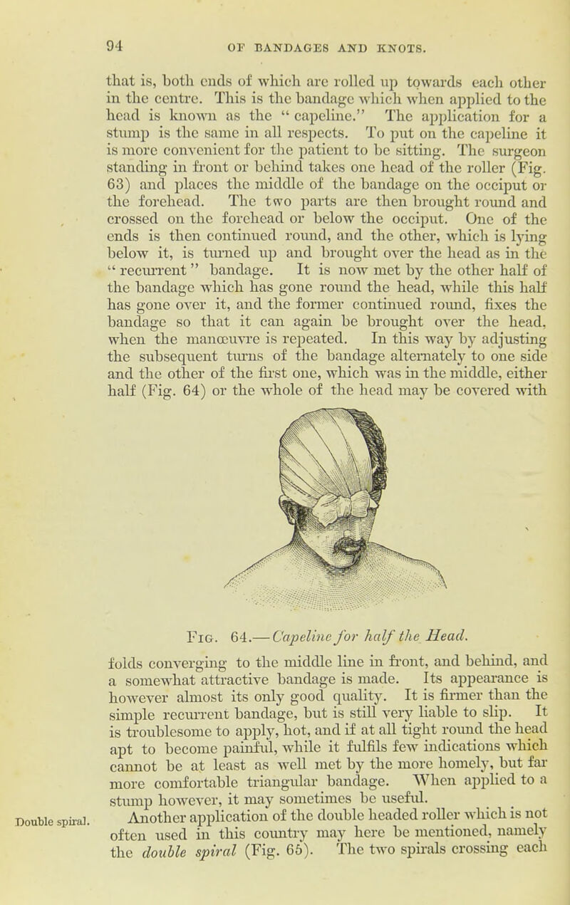 Double spiral. that is, both ends of which arc rolled up towards each other in the centre. This is the bandage which when applied to the head is known as the “ capeline.” The application for a stump is the same in all respects. To put on the capeline it is more convenient for the patient to be sitting. The surgeon Standing in front or behind takes one head of the roller (Fig. 63) and places the middle of the bandage on the occiput or the forehead. The two parts are then brought round and crossed on the forehead or below the occiput. One of the ends is then continued round, and the other, which is tying below it, is turned up and brought over the head as in the “ recurrent ” bandage. It is now met by the other half of the bandage which has gone round the head, while this half has gone over it, and the former continued round, fixes the bandage so that it can again be brought over the head, when the manoeuvre is repeated. In this way by adjusting the subsequent turns of the bandage alternately to one side and the other of the first one, which was in the middle, either half (Fig. 64) or the whole of the head may be covered with Fig. 64.— Capeline for half the Head. folds converging to the middle line in front, and behind, and a somewhat attractive bandage is made. Its appearance is however almost its only good quality. It is firmer than the simple recurrent bandage, but is still very liable to slip. It is troublesome to apply, hot, and if at all tight round the head apt to become painful, while it fulfils few indications which cannot be at least as well met by the more homely, but far more comfortable triangular bandage. When applied to a stump however, it may sometimes be useful. Another application of the double headed roller which is not often used in this country may here be mentioned, namely the double spiral (Fig. 65). The two spirals crossing each