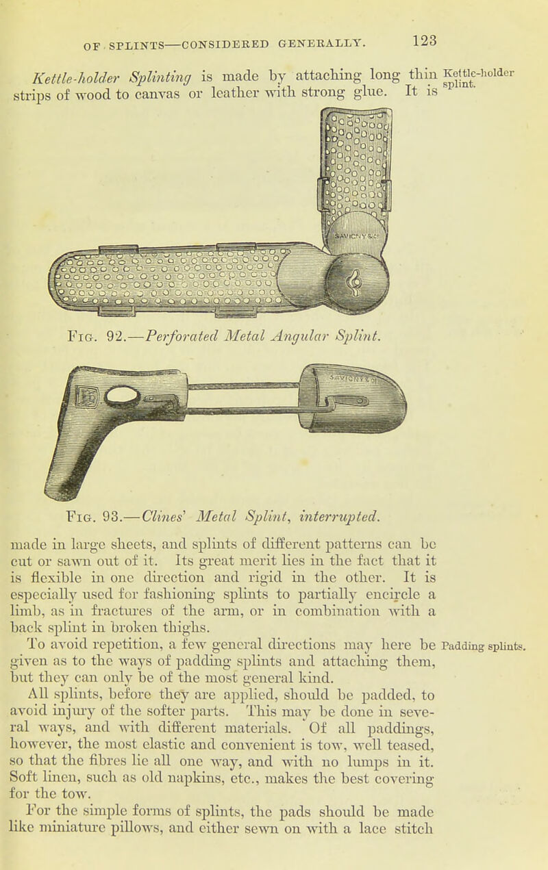 Kettle-holder Splinting is made by attaching long thin Kettle-holder strips of wood to canvas or leather with strong glue. It is Fig. 92.—Perforated Metal Angular Splint. Fig. 93.— Clines' Metal Splint, interrupted. made in large sheets, and splints of different patterns can be cut or sawn out of it. Its great merit lies in the fact that it is flexible in one direction and rigid in the other. It is especially used for fashioning splints to partially encircle a limb, as in fractures of the arm, or in combination with a back splint in broken thighs. To avoid repetition, a few general directions may here be Padding splints, given as to the ways of padding splints and attaching them, but they can only be of the most general kind. All splints, before they are applied, shoidd be padded, to avoid injury of the softer parts. This may be done in seve- ral ways, and with different materials. Of all paddings, however, the most clastic and convenient is tow, well teased, so that the fibres lie all one way, and with no lumps in it. Soft linen, such as old napkins, etc., makes the best covering for the tow. For the simple forms of splints, the pads should be made like miniature pillows, and either sewn on with a lace stitch