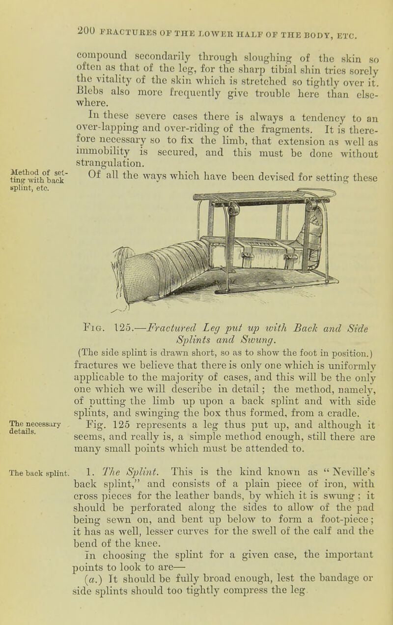 Method of set- ting: with hack splint, etc. The necessary- details. The back splint. 200 FBACTUEES OF THE LOWER HALF OF THE BODY, ETC. compound secondarily through sloughing of the skin so often as that of the leg, for the sharp tibial shin tries sorely the vitality of the skin which is stretched so tightly over it. Blebs also more frequently give trouble here than else- where. In these severe cases there is always a tendency to an over-lapping and over-riding of the fragments. It is there- fore necessary so to fix the limb, that extension as well as immobility is secured, and this must be done without strangulation. Of all the ways which have been devised for setting these Fig. 125.—Fractured Leg put up with Back and Side Splints and Swung. (The side splint is drawn short, so as to show the foot in position.) fractures we believe that there is only one which is uniformly aiiplicable to the majority of cases, and this will be the only one which we will describe in detail; the method, namely, of putting the limb up upon a back splint and with side splints, and swinging the box thus formed, from a cradle. Fig. 125 represents a leg thus put up, and although it seems, and really is, a simple method enough, still there are many small points which must be attended to. 1. The Splint. This is the kind known as “Neville’s back splint,” and consists of a plain piece of iron, with cross pieces for the leather bands, by which it is swung ; it should be perforated along the sides to allow of the pad being sewn ou, and bent up below to form a foot-piece; it has as well, lesser curves for the swell of the calf and the bend of the knee. In choosing the splint for a given case, the important points to look to are— (a.) It should be fully broad enough, lest the bandage or side splints should too tightly compress the leg