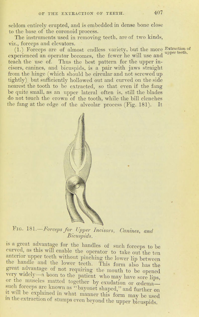 seldom entirely erupted, and is embedded in dense bone close to tlic base of the coronoid process. The instruments used in removing teeth, are of two kinds, viz., forceps and elevators. (1.) Forceps are of almost endless variety, but the more experienced an operator becomes, the fewer he will use and teach the use of. Thus the best pattern for the upper in- cisors, canines, and bicuspids, is a pair with jaws straight from the hinge (which should be circular and not screwed up tightly), but sufficiently hollowed out and curved on the side nearest the tooth to be extracted, so that even if the fang be quite small, as an upper lateral often is, still the blades do not touch the crown of the tooth, while the bill clenches the fang at the edge of the alveolar process (Fig. 181). It kiG. 181.—Forceps for Upper Incisors, Bicuspids. Canines, and is a gieat advantage for the handles of such forceps to be curved, as this will enable the operator to take out the ten anterior upper teeth without pinching the lower lip between the handle and the lower teeth. This form also has the gieat advantage of not requiring the mouth to be opened very widely--a boon to the patient who may have sore lips, or the muscles matted together by exudation or oedema- such forceps are known as “bayonet shaped,” and further on it will be explained m what manner this form may be used m the extraction of stumps even beyond the upper bicuspids Extraction of upper teeth.