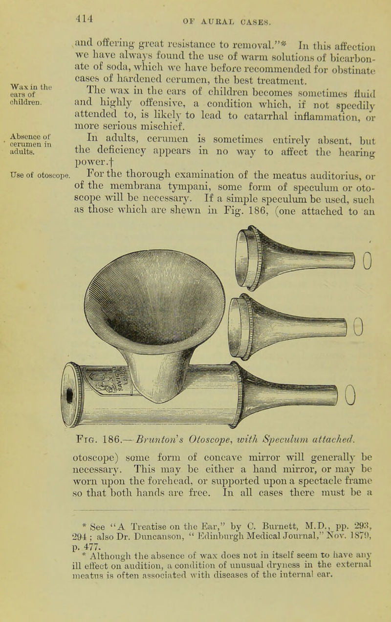 Wax iu the ears of children. Absence of cerumen in adults. Use of otoscope. and offering1 great resistance to removal.”* In this affection we have always found the use of warm solutions of bicarbon- ate of soda, which we have before recommended for obstinate cases of hardened cerumen, the best treatment. fhe wax in the ears of children becomes sometimes fluid and highly offensive, a condition which, if not speedily attended to, is likely to lead to catarrhal inflammation, or more serious mischief. In adults, cerumen is sometimes entirely absent, but the deficiency appears in no way to affect the hearing power.f For the thorough examination of the meatus auditorius, or of the membrana tympani, some form of speculum or oto- scope will be necessary. If a simple speculum be used, such as those which are shewn in Fig. 186, (one attached to an Fro. 186.— Brunton’s Otoscope, with Speculum attached. otoscope) some form of concave mirror will generally he necessary. This may be either a hand mirror, or may be worn upon the forehead, or supported upon a spectacle frame so that both hands are free. In all cases there must be a * See “A Treatise on the Ear,” by C. Burnett, M.D., pp. '293, 294; also Dr. Duncan son, “ Edinburgh Medical Journal,” Nov. 1S79, p. 477. * Although the absence of wax does not in itself seem to have any ill effect on audition, a condition of unusual dryness in the external meatus is often associated with diseases of the internal ear.