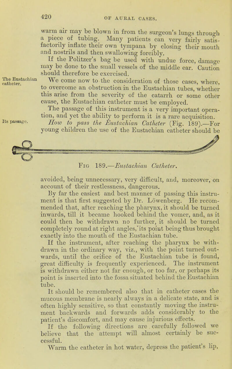 waun tin may lie blown in from the surgeon’s lungs through a piece of tubing. Many patients can very fairly satis- factorily inflate their own tympana by closing their mouth and nostrils and then swallowing forcibly. If the Politzer’s bag be used with undue force, damage may be done to the small vessels of the middle ear. Caution should therefore be exercised. Shetefto(lhian We come now to tlie consideration of those cases, where, to overcome an obstruction in the Eustachian tubes, whether this arise from the severity of the catarrh or some other cause, the Eustachian catheter must be employed. The passage of this instrument is a very important opera- tion, and yet the ability to perform it is a rare acquisition. Its passage. Hoiv to pass the Eustachian Catheter (Fig. 189).—For young children the use of the Eustachian catheter should be avoided, being unnecessary, very difficult, and, moreover, on account of their restlessness, dangerous. By far the easiest and best manner of passing this instru- ment is that first suggested by Dr. Lowenberg. He recom- mended that, after reaching the pharynx, it should be turned inwards, till it became hooked behind the vomer, and,, as it could then be withdrawn no further, it should be turned completely round at right angles,its point being thus brought exactly into the mouth of the Eustachian tube. If the instrument, after reaching the pharynx be with- drawn in the ordinary way, viz., with the point turned out- wards, until the orifice of the Eustachian tube is found, great difficulty is frequently experienced. The instrument is withdrawn either not far enough, or too far, or perhaps its point is inserted into the fossa situated behind the Eustachian tube. It should be remembered also that in catheter cases the mucous membrane is nearly always in a delicate state, and is often highly sensitive, so that constantly moving the instru- ment backwards and forwards adds considerably to the patient’s discomfort, and may cause injurious effects. If the following directions are carefully followed we believe that the attempt will almost certainly be suc- cessful. Warm the catheter in hot water, depress the patient’s lip,