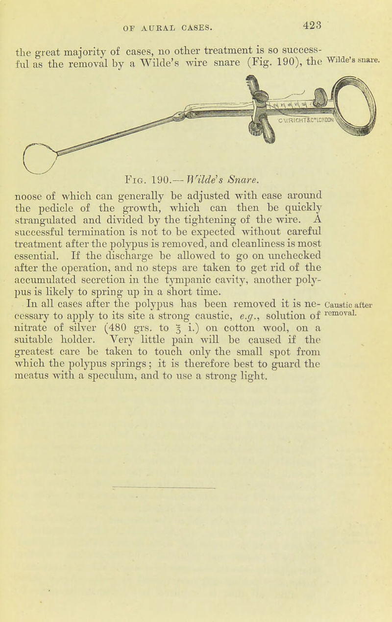 the great majority of cases, no other treatment is so success- ful as the removal by a Wilde’s wire snare (Fig. 190), the Wilde’s snare. Fig. 190.— Wilde's Snare. noose of which can generally he adjusted with ease around the pedicle of the growth, which can then he quickly strangulated and divided by the tightening of the wire. A successful termination is not to be expected without careful treatment after the polypus is removed, and cleanliness is most essential. If the discharge be allowed to go on unchecked after the operation, and no steps are taken to get rid of the accumulated secretion in the tympanic cavity, another poly- pus is likely to spring up in a short time. In all cases after the polypus has been removed it is ne- Caustic after cessary to apply to its site a strong caustic, e.g., solution of removal- nitrate of silver (480 grs. to 3 i.) on cotton wool, on a suitable holder. Very little pain will be caused if the greatest care be taken to touch only the small spot from which the polypus springs; it is therefore best to guard the meatus with a speculum, and to use a strong light.