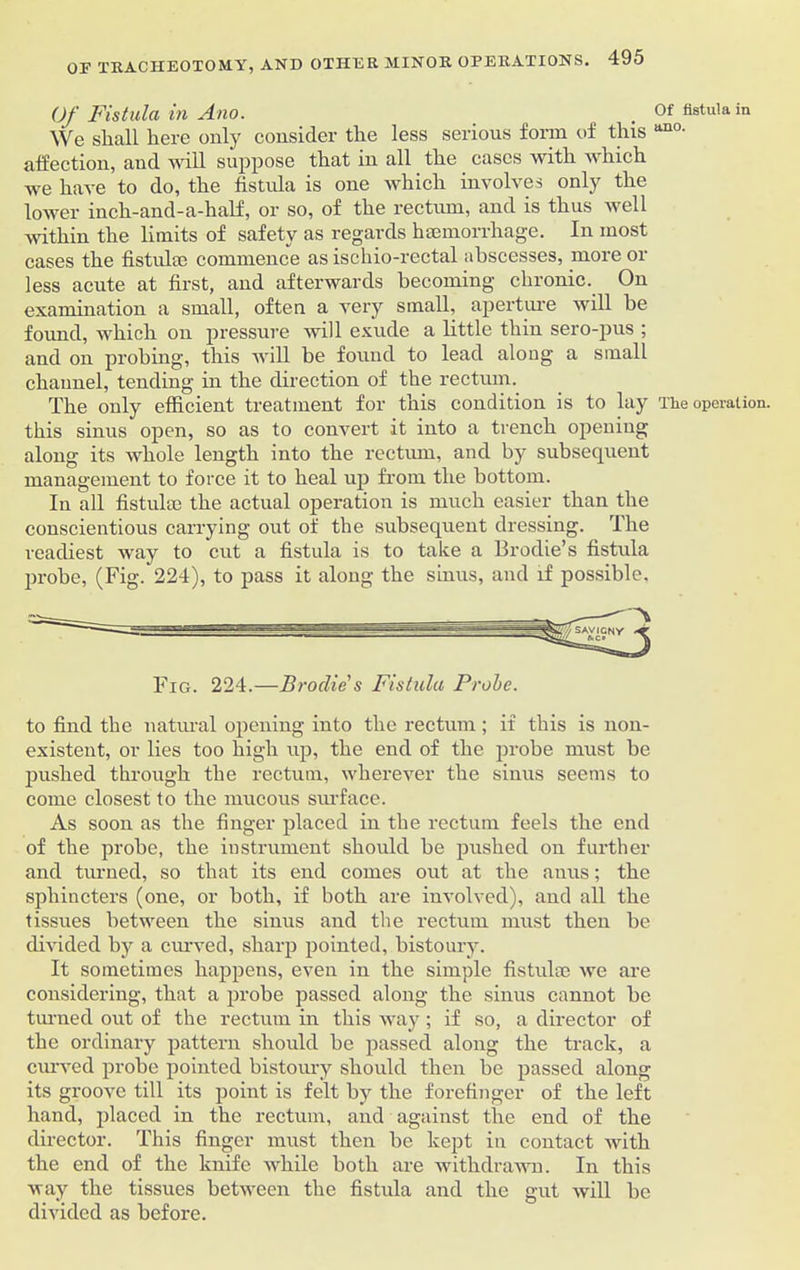 Of Fistula in Ano. . Of fistula in We shall here only consider the less serious form of this an0- affection, and will suppose that in all the cases with which we have to do, the fistula is one which involves only the lower inch-and-a-half, or so, of the rectum, and is thus well within the limits of safety as regards haemorrhage. In most cases the fistuhe commence as ischio-rectal abscesses, more or less acute at first, and afterwards becoming chronic. On examination a small, often a very small, aperture will be found, which on pressure will exude a little thin sero-pus ; and on probing, this will be found to lead along a small channel, tending in the direction of the rectum. The only efficient treatment for this condition is to lay The operation, this sinus open, so as to convert it into a trench opening along its whole length into the rectum, and by subsequent management to force it to heal up from the bottom. In all fistulai the actual operation is much easier than the conscientious carrying out of the subsequent dressing. The readiest way to cut a fistula is to take a Brodie’s fistula probe, (Fig. 224), to pass it along the sinus, and if possible. Fig. 224.—Broclie's Fistula Probe. to find the natural opening into the rectum; if this is non- existent, or lies too high up, the end of the probe must be pushed through the rectum, wherever the sinus seems to come closest to the mucous surface. As soon as the finger placed in the rectum feels the end of the probe, the instrument should be pushed on further and turned, so that its end comes out at the anus; the sphincters (one, or both, if both are involved), and all the tissues between the sinus and the rectum must then be divided by a curved, sharp pointed, bistoury. It sometimes happens, even in the simple fistulm we are considering, that a probe passed along the sinus cannot be turned out of the rectum in this way; if so, a director of the ordinary pattern should be passed along the track, a curved probe pointed bistoury should then be passed along its groove till its point is felt by the forefinger of the left hand, placed in the rectum, and against the end of the director. This finger must then be kept in contact with the end of the knife while both are withdrawn. In this way the tissues between the fistula and the gut will be divided as before.