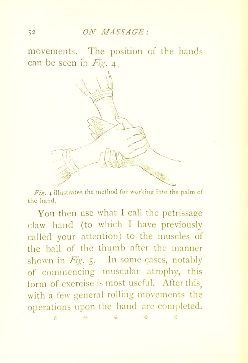 movements. The position of the hands can be seen in Fig. 4. Fig. 4 illustrates the method for workiiiE; Into the pnlm of tlie hand. You then use what I call the petrissage claw hand (to which I have previously called your attention) to the muscles of the ball of the thumb after the manner shown in Fig. 5. In some cases, notably of commencing muscular atrojihy, this form of exercise is most useful. After this^ with a few general rolling movements the operations upon the hand are completed.