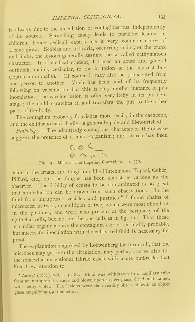 is always due to the inoculation of contagious pus, independently of its source. Scratching easily leads to purulent lesions in children, hence pediculi capitis are a very common cause of I. contagiosa. Scabies and urticaria, occurring mainly on the trunk and limbs, the lesions generally assume the so-called ecthymatous character. In a medical student, I traced an acute and general outbreak, mainly vesicular, to the irritation of the harvest bug (leptus autumnalis). Of course it may also be propagated from one person to another. Much has been said of its frequently following on vaccination, but this is only another instance of pus inoculation; the vaccine lesion is often very itchy in its purulent stage; the child scratches it, and transfers the pus to the other parts of the body. The contagium probably flourishes more easily in the cachectic, and the child who has it badly, is generally pale and ill-nourished. Pathology—The admittedly contagious character of the disease suggests the presence of a micro-organism; and search has been Fig. 13.—Micrococci of Impetigo Contagiosa. x 550. made in the crusts, and fungi found by Hutchinson, Kaposi, Geber, Piffard, etc., but the fungus has been almost as various as the observer. The liability of crusts to be contaminated is so great that no deduction can be drawn from such observations. In the fluid from unruptured vesicles and pustules* I found chains of micrococci in twos, or multiples of two, which were most abundant in the pustules, and were also present at the periphery of the epithelial cells, but not in the pus cells as in fig. 13. That these or similar organisms are the contagium carriers is highly probable, but successful inoculation with the cultivated fluid is necessary for proof. The explanation suggested by Loewenberg for furunculi, that the microbes may get into the circulation, may perhaps serve also for the somewhat exceptional febrile cases with acute outbreaks that Fox drew attention to. * Lancet (1881), vol. i„ p. 82. Fluid was withdrawn in a capillary tube from an unruptured vesicle and blown upon a cover glass, dried, and stained with methyl violet. The lesions were then readily observed with an object glass magnifying 550 diameters.
