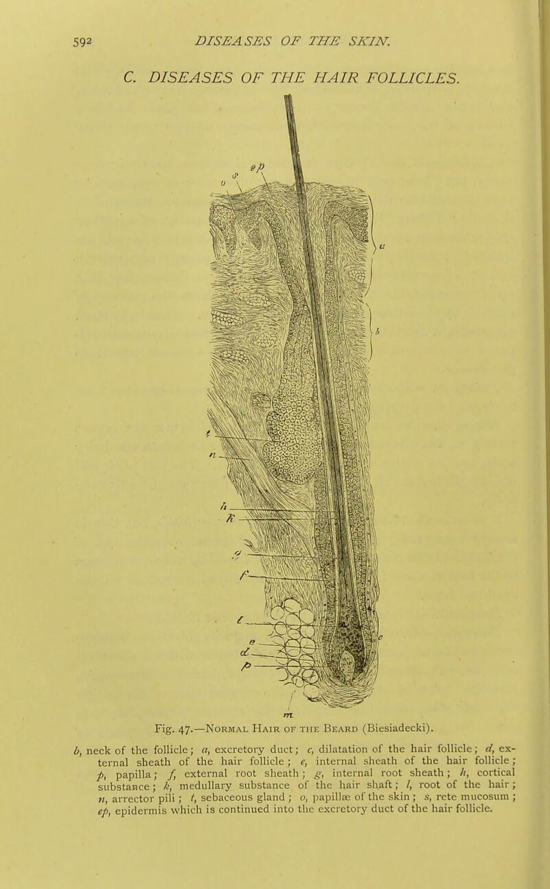 C. DISEASES OF THE HAIR FOLLICLES. m Fig. 47.—Normal Hair of the Beard (Biesiadecki). b, neck of the follicle; a, excretory duct; c, dilatation of the hair follicle; d, ex- ternal sheath of the hair follicle ; c, internal sheath of the hair follicle; p, papilla; f, external root sheath; g, internal root sheath; /;, cortical substance; k, medullary substance of the hair shaft; /, root of the hair; n, arrector pili; /, sebaceous gland ; 0, papilla? of the skin ; s, rete mucosum ; cp, epidermis which is continued into the excretory duct of the hair follicle.